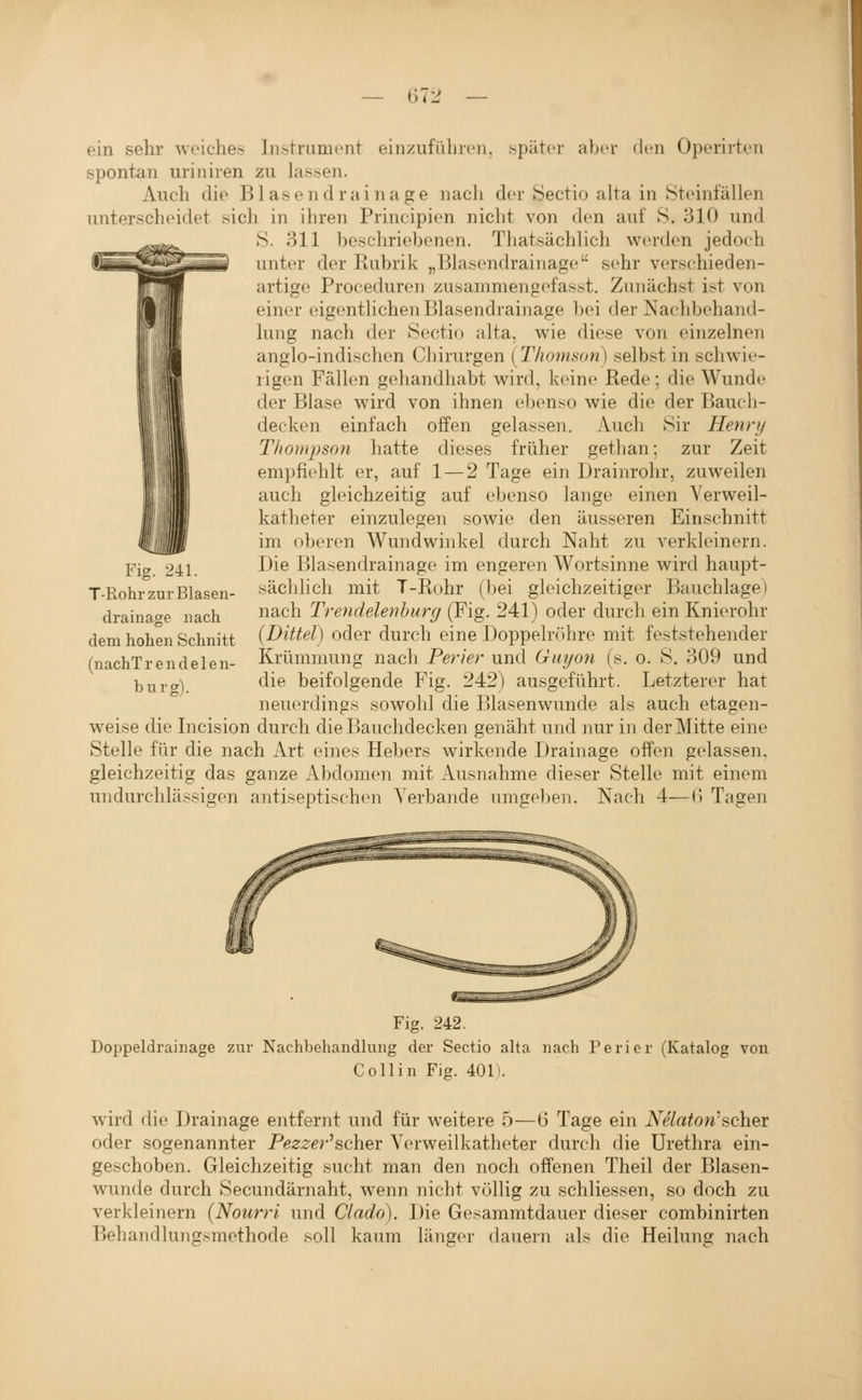 ein sehr woiche.s Instrumont einzufüliren. i^päter aber den Operirten spontan uriniien zu las.^en. Auch die B1 äsendrainage nach der Sectio alta in Stemfällen unterscheidet sich in ihren Principien nicht von den auf S. 310 und S. 311 beschriebenen. Thatsächlich werden jedoch unter der Rubrik „Bhasendrainage sehr verschieden- artige Proceduren zusammengefasst. Zunächst ist von einer eigenthchen Blasendrainage bei der Nachbehand- hmg nach der Sectio alta, wie diese von einzelnen anglo-indischen Chirurgen [Thomson) selbst in schwie- rigen Fällen gehandhabt Avird, keine Rede; die Wunde der Blase wird von ihnen ebenso wie die der Bauch- decken einfach offen gelassen. Auch Sir Henry Thompson hatte dieses früher gethan; zur Zeit empfiehlt er, auf 1 — 2 Tage ein Drainrohr, zuweilen auch gleichzeitig auf ebenso lange einen Verweil- katheter einzulegen sowie den äusseren Einschnitt im oberen Wundwinkel durch Naht zu verkleinern. Die Blasendrainage im engeren Wortsinne wird haupt- sächlich mit T-Rohr (bei gleichzeitiger Bauchlage) nach Trendelenhurg (Fig. 241) oder durch ein Knierohr (Dittel) oder durch eine Doppelröhre mit feststehender Krümmung nacli Perier und Guyon (s. o. S. 309 und die beifolgende Fig. 242) ausgeführt. Letzterer hat neuerdings sowohl die Blasen wunde als auch etagen- weise die Incision durch die Bauchdecken genäht und nur in der jMitte eine Stelle für die nach Art eines Hebers wirkende Drainage offen gelassen, gleichzeitig das ganze Abdomen mit Ausnahme dieser Stelle mit einem undurchlässigen antiseptischen Verbände umgeben. Nach 4—(> Tagen Fig. 241. T-Rohr zur Blasen- drainage nach dem hohen Schnitt (nachTrendelen- burg). Fig. 242. Doppeldrainage zur Nachbehandlung der Sectio alta nach Perier (Katalog von Colli n Fig. 401). wird die Drainage entfernt und für weitere 5—6 Tage ein Nelaton'soh^r oder sogenannter Pe^^-^r'scher Verweilkatheter durch die Urethra ein- geschoben. Gleichzeitig sucht man den noch offenen Theil der Blasen- wunde durch Secundärnaht, wenn nicht völlig zu schliessen, so doch zu verkleinern [Nourri und Clado). Die Gesammtdauer dieser combinirten Behandlungsmethode soll kaum länger dauern als die Heilung nach