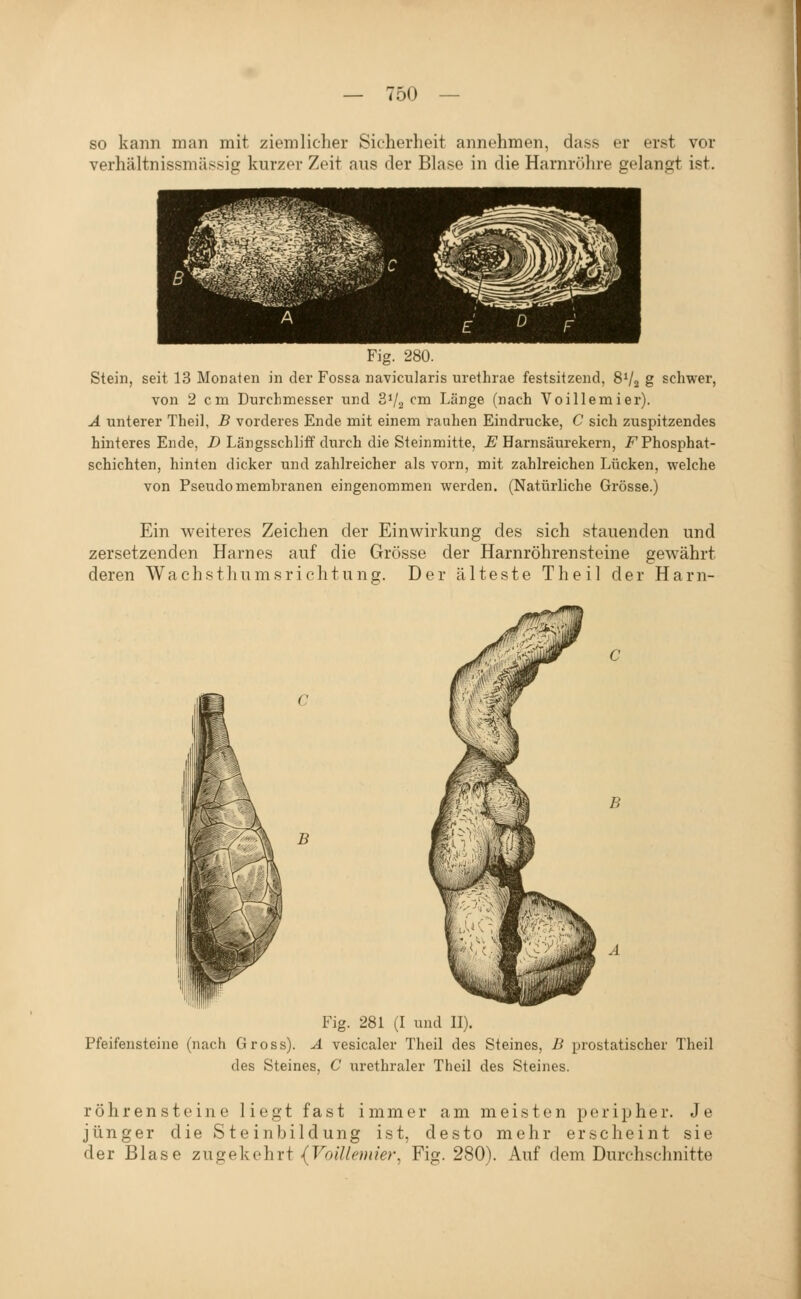 so kann man mit ziemlicher Sicherheit annehmen, dass er erst vor verhältnissmässig kurzer Zeit ans der Blase in die Harnr(>ln-e gelangt ist. Fig. 280. Stein, seit 13 Monaten in der Fossa navicularis urethrae festsitzend, 8V2 g schwer, von 2 cm Durchmesser und 31/2 cm Länge (nach Voillemier). Ä unterer Theil, B vorderes Ende mit einem rauhen Eindrucke, C sich zuspitzendes hinteres Ende, D Längsschliff durch die Steinmitte, £ Harnsäurekern, F Phosphat- schichten, hinten dicker und zahlreicher als vorn, mit zahlreichen Lücken, welche von Pseudomembranen eingenommen werden. (Natürliche Grösse.) Ein weiteres Zeichen der Einwirkung des sich stauenden und zersetzenden Harnes auf die Grösse der Harnröhrensteine gewährt deren Wachstliumsrichtung. Der älteste Theil der Harn- B B Fig. 281 (I und II). Pfeifensteine (nach Gross). A vesicaler Theil des Steines, B prostatischer Theil des Steines, C urethraler Theil des Steines. röhren steine liegt fast immer am meisten peripher. Je jünger die S te inbild U2ig ist, desto mehr erscheint sie der Blase zugekehrt {Foj7/^m?V;-, Fig. 280). Auf dem Durchschnitte