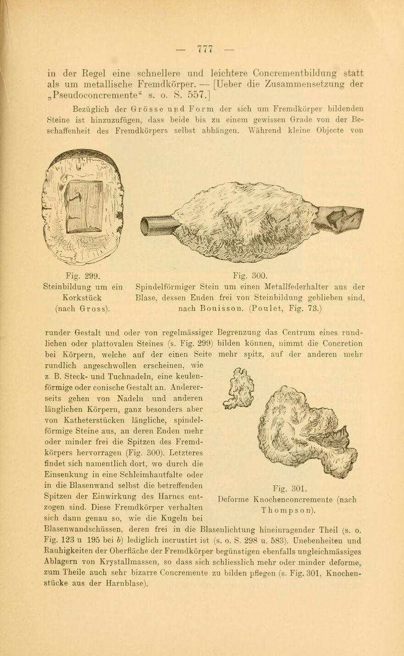 in der Regel eine schnellere und leichtere Concrementbildnng statt als um metallische Fremdkörper. — [üeber die Zusammensetzung der „Pseudoconcremente s. o. S. 557.] Bezüglich der Grösse und Form der sich um Fremdkörper bildenden Steine ist hinzuzufügen, dass beide bis zu einem gewissen Grade von der Be- schaffenheit des Fremdkörpers selbst abhängen. Während kleine Objecte von Fig. 299. Steinbildung um ein Korkstück (nach Gross). mmm Fig. 300. Spindelförmiger Stein um einen Metallfederhalter aus der Blase, dessen Enden frei von Steinbildung geblieben sind, nach Bouisson. (Foulet, Fig. 73.) runder Gestalt und oder von regelmässiger Begrenzung das Centrum eines rund- lichen oder plattovalen Steines (s. Fig. 299) bilden können, nimmt die Concretion bei Körpern, welche auf der einen Seite mehr spitz, auf der anderen mehr rundlich angeschwollen erscheinen, wie z. B. Steck- und Tuchnadeln, eine keulen- förmige oder conische Gestalt an. Anderer- seits gehen von Nadeln und andei'en länglichen Körpern, ganz besonders aber von Katheterstücken längliche, spindel- förmige Steine aus, an deren Enden mehr oder minder frei die Spitzen des Fremd- körpers hervorragen (Fig. 300). Letzteres findet sich namentlich dort, wo durch die Einsenkung in eine Schleimhautfalte oder in die Blasenwand selbst die betreffenden Spitzen der Einwirkung des Harnes ent- zogen sind. Diese Fremdkörper verhalten sich dann genau so, wie die Kugeln bei Blasenwandschüssen, deren frei in die Blasenlichtung hineinragender Theil (s. o. Fig. 123 u 195 bei h) lediglich incrustirt ist (s. o. S. 298 u. 583). Unebenheiten und Eauhigkeiten der Oberfläche der Fremdkörper begünstigen ebenfalls ungleichmässiges Ablagern von Krystallmassen. so dass sich schliesslich mehr oder minder deforme, zum Theile auch sehr bizarre Concremente zu bilden pflegen (s. Fig. 301, Knochen- stücke aus der Harnblase). Fig. 301. Deforme Knochenconcremente (nach Thomp son).