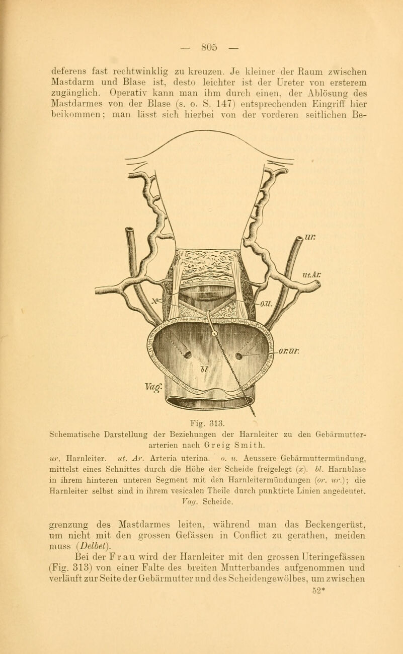 deferens fast reclitwinklig zu kreuzen. Je kleiner der Raum zwischen Mastdarm und Blase ist, desto leichter ist der Ureter von ersterem zugänglich. Operativ kann man ihm durch einen, der Ablösung des Mastdarmes von der Blase (s. o. S. 147) entsprechenden Eingriff hier beikommen: man lässt sich hierbei von der vorderen seitlichen Be- Fig. 313. Schematische Darstellung der Beziehungen der Harnleiter zu den Gebärmutter- arterien nach Greig Smith. ur. Harnleiter. ut. Ar. Arteria uterina. ». u. Aeussere Gebärmuttermündung, mittelst eines Schnittes durch die Höhe der Scheide freigelegt (x). bJ. Harnblase in ihrem hinteren unteren Segment mit den Harnleiiermündungen {or. nr.); die Harnleiter selbst sind in ihrem vesicalen Theile durch punktirte Linien angedeutet. Vcifj. Scheide. grenzung des Mastdarmes leiten, während man das Beckengerüst, um nicht mit den grossen Gefässen in Conflict zu gerathen, meiden muss (Delbet). Bei der Frau wird der Harnleiter mit den grossen TJteringefässen (Fig. 313) von einer Falte des breiten Mutterbandes aufgenommen und verläuft zur Seite der Gebärmutter und des Scheidengewölbes, um zwischen 52*