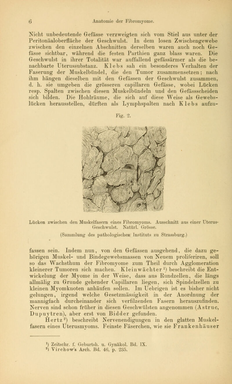 Nicht unbedeutende Gefässe verzweigten sich vom Stiel aus unter der Peritonäaloberfläche der Geschwulst. In dem losen Zwischengewebe zwischen den einzelnen Abschnitten derselben waren auch noch Ge- fässe sichtbar, während die festen Parthien ganz blass waren. Die Geschwulst in ihrer Totalität war auffallend gefässärmer als die be- nachbarte Uterussubstanz. Klebs sah ein besonderes Verhalten der Faserung der Muskelbündel, die den Tumor zusammensetzen; nach ihm hängen dieselben mit den Gefässen der Geschwulst zusammen, d. h. sie umgeben die grösseren capillaren Gefässe, wobei Lücken resp. Spalten zwischen diesen Muskelbündeln und den Gefässscheiden sich bilden. Die Hohlräume, die sich auf diese Weise als Gewebs- lücken herausstellen, dürften als Lymphspalten nach Klebs aufzu- Fig. 2. i »v' •g Jä£T#v. <: Lücken zwischen den Muskelfasern eines Fibromyoms. Ausschnitt aus einer Uterus- Geschwulst. Natürl. Grösse. (Sammlung- des pathologischen Instituts zu Strassburg.) fassen sein. Indem nun, von den Gefässen ausgehend, die dazu ge- hörigen Muskel- und Bindegewebsmassen von Neuem proliteriren, soll so das Wachsthum der Fibromyome zum Theil durch Agglomeration kleinerer Tumoren sich machen. Kleinwächter1) beschreibt die Ent- wickelung der Myome in der Weise, dass aus Rundzellen, die längs allmälig zu Grunde gehender Capillaren liegen, sich Spindelzellen zu kleinen Myomknoten anhäufen sollen. Im Uebrigen ist es bisher nicht gelungen, irgend welche Gesetzmässigkeit in der Anordnung der mannigfach durcheinander sich verfilzenden Fasern herauszufinden. Nerven sind schon früher in diesen Geschwülsten angenommen (Astruc, Dupuytren), aber erst von Bidder gefunden. Hertz2) beschreibt Nervenendigungen in den glatten Muskel- fasern eines Uterusmyoms. Feinste Fäserchen, wie sie Frankenhäuser !) Zeitschr. f. Geburtsh. u. Gynäkol. Bd. IX. 2) Virchow's Arch. Bd. 46, p. 235.