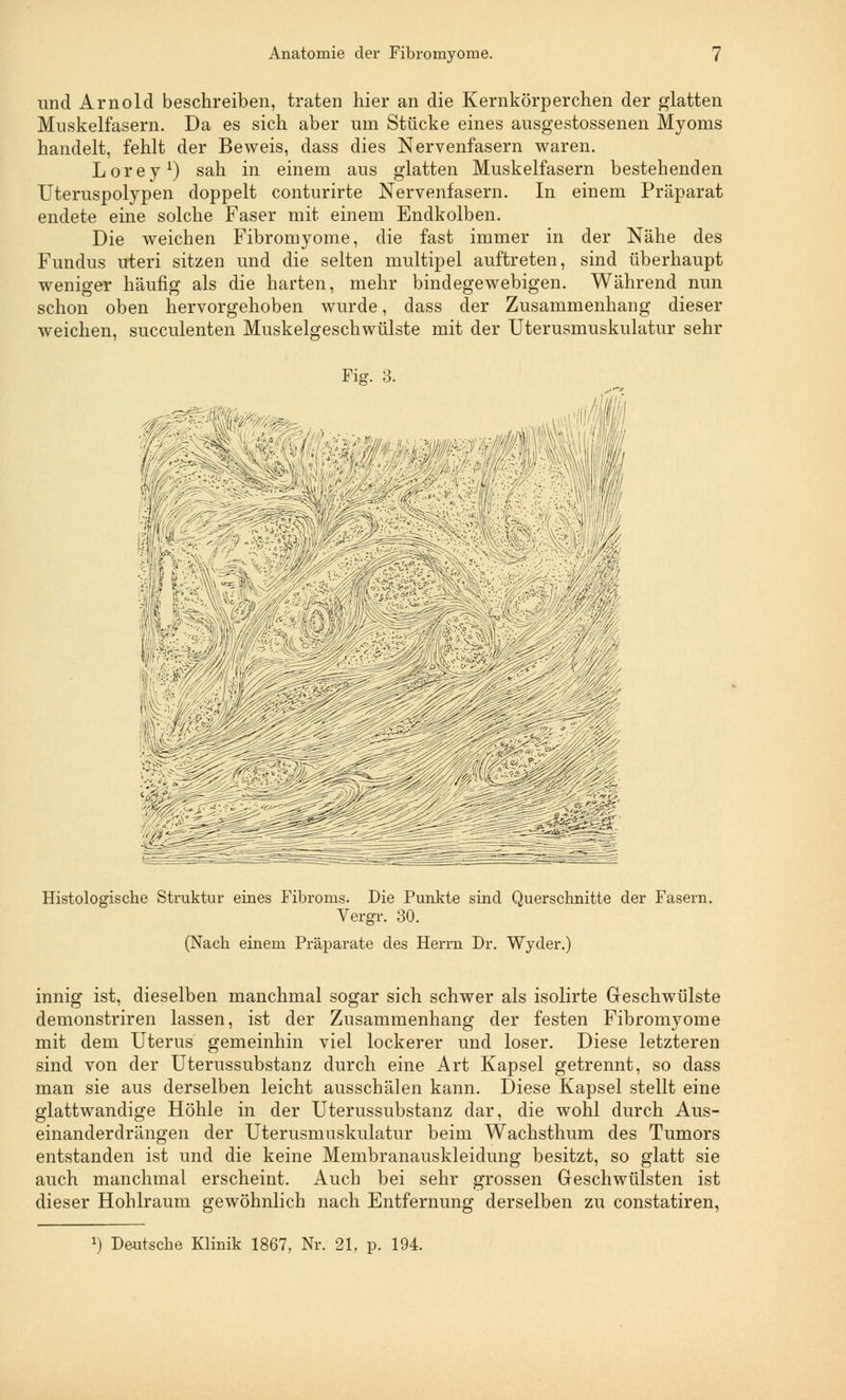 und Arnold beschreiben, traten hier an die Kernkörperchen der glatten Muskelfasern. Da es sich aber um Stücke eines ausgestossenen Myoms handelt, fehlt der Beweis, dass dies Nervenfasern waren. Lorey1) sah in einem aus glatten Muskelfasern bestehenden Uteruspolypen doppelt conturirte Nervenfasern. In einem Präparat endete eine solche Faser mit einem Endkolben. Die weichen Fibromyome, die fast immer in der Nähe des Fundus uteri sitzen und die selten multipel auftreten, sind überhaupt weniger häufig als die harten, mehr bindegewebigen. Während nun schon oben hervorgehoben wurde, dass der Zusammenhang dieser weichen, succulenten Muskelgeschwülste mit der Uterusmuskulatur sehr Fig. 3. Histologische Struktur eines Fibroms. Die Punkte sind Querschnitte der Fasern. Vergr. 30. (Nach einem Präparate des Herrn Dr. Wyder.) innig ist, dieselben manchmal sogar sich schwer als isolirte Geschwülste demonstriren lassen, ist der Zusammenhang der festen Fibromyome mit dem Uterus gemeinhin viel lockerer und loser. Diese letzteren sind von der Uterussubstanz durch eine Art Kapsel getrennt, so dass man sie aus derselben leicht ausschälen kann. Diese Kapsel stellt eine glattwandige Höhle in der Uterussubstanz dar, die wohl durch Aus- einanderdrängen der Uterusmuskulatur beim Wachsthum des Tumors entstanden ist und die keine Membranauskleidung besitzt, so glatt sie auch manchmal erscheint. Auch bei sehr grossen Geschwülsten ist dieser Hohlraum gewöhnlich nach Entfernung derselben zu constatiren, !) Deutsche Klinik 1867, Nr. 21, p. 194.