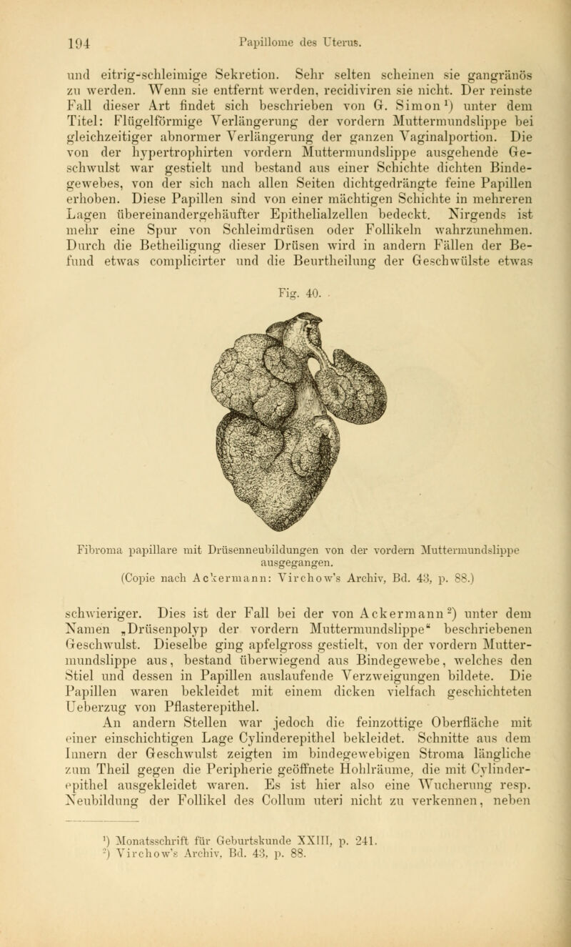 und eitrig-schleimige Sekretion. Sehr selten scheinen sie gangränös zu werden. Wenn sie entfernt werden, recidiviren sie nicht. Der reinste Fall dieser Art findet sich beschrieben von G. Simon1) unter dem Titel: Flügeiförmige Verlängerung der vordem Muttermundslippe bei gleichzeitiger abnormer Verlängerung der ganzen Vaginalportion. Die von der hypertrophirten vordem Muttermundslippe ausgehende Ge- schwulst war gestielt und bestand aus einer Schichte dichten Binde- gewebes, von der sich nach allen Seiten dichtgedrängte feine Papillen erhoben. Diese Papillen sind von einer mächtigen Schichte in mehreren Lagen übereinandergehäufter Epithelialzellen bedeckt. Nirgends ist mehr eine Spur von Schleimdrüsen oder Follikeln wahrzunehmen. Durch die Betheiligung dieser Drüsen wird in andern Fällen der Be- fund etwas complicirter und die Beurtheilung der Geschwülste etwas Fig. 40. Fibroma papilläre mit Drüsenneubildungen von der vordem Muttermundslippe ausgegangen. (Copie nach Ackermann: Virchow's Archiv, Bd. 43, p. 88.) schwieriger. Dies ist der Fall bei der von Ackermann 2) unter dem Namen „Drüsenpolyp der vordem Muttermundslippea beschriebenen Geschwulst. Dieselbe ging apfelgross gestielt, von der vordem Mutter- mundslippe aus, bestand überwiegend aus Bindegewebe, welches den Stiel und dessen in Papillen auslaufende Verzweigungen bildete. Die Papillen waren bekleidet mit einem dicken vielfach geschichteten Ueberzug von Pflasterepithel. An andern Stellen war jedoch die feinzottige Oberfläche mit piner einschichtigen Lage Cylinderepithel bekleidet. Schnitte aus dem Innern der Geschwulst zeigten im bindegewebigen Stroma längliche zum Theil gegen die Peripherie geöffnete Hohlräume; die mit Cylinder- epithel ausgekleidet waren. Es ist hier also eine Wucherung resp. Neubildung der Follikel des Collum uteri nicht zu verkennen, neben ') Monatsschrift für Geburtskunde XXIII, p. 241, -) Virchow'e Archiv, Bd. 43, p. 88.