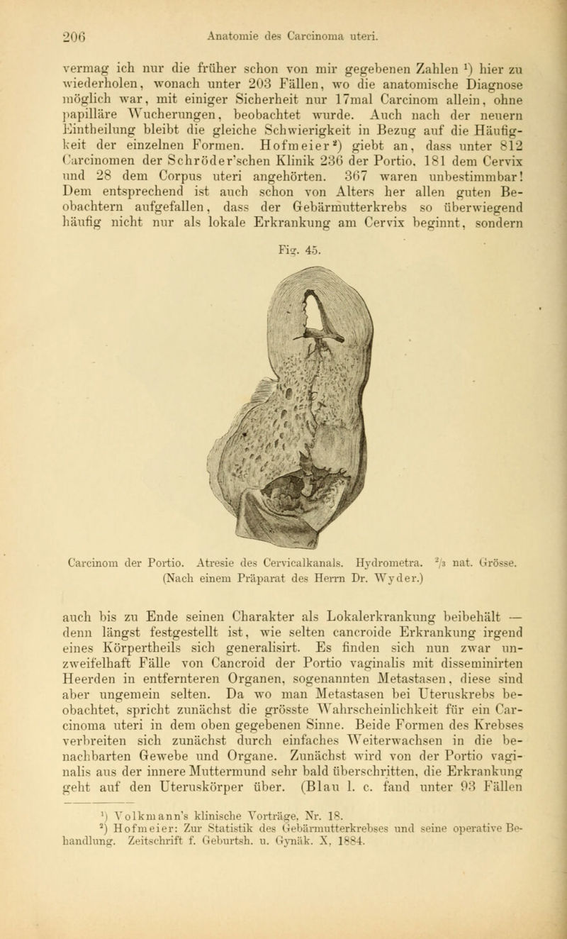 vermag ich nur die früher schon von mir gegebenen Zahlen x) hier zu wiederholen, wonach unter 203 Fällen, wo die anatomische Diagnose möglich war, mit einiger Sicherheit nur 17mal Carcinom allein, ohne papilläre Wucherungen, beobachtet wurde. Auch nach der neuern Einth eilung bleibt die gleiche Schwierigkeit in Bezug auf die Häufig- keit der einzelnen Formen. Hofmeier2) giebt an, dass unter 812 Carcinomen der Schröder'schen Klinik 236 der Portio, 181 dem Cervix und 28 dem Corpus uteri angehörten. 367 waren unbestimmbar! Dem entsprechend ist auch schon von Alters her allen guten Be- obachtern aufgefallen, dass der Gebärmutterkrebs so überwiegend häufig nicht nur als lokale Erkrankung am Cervix beginnt, sondern Fi^-. 45. Carcinom der Portio. Atresie des Cervicalkanals. Hydrometra. -' 3 nat. Grösse. (Nach einem Präparat des Herrn Dr. Wyder.) auch bis zu Ende seinen Charakter als Lokalerkrankung beibehält — denn längst festgestellt ist, wie selten cancroide Erkrankung irgend eines Körpertheils sich generalisirt. Es finden sich nun zwar un- zweifelhaft Fälle von Cancroid der Portio vaginalis mit disseminirten Heerden in entfernteren Organen, sogenannten Metastasen. diese sind aber ungemein selten. Da wo man Metastasen bei Uteruskrebs be- obachtet, spricht zunächst die grösste Wahrscheinlichkeit für ein Car- cinoma uteri in dem oben gegebenen Sinne. Beide Formen des Krebses verbreiten sich zunächst durch einfaches AYeiterwaehsen in die be- nachbarten Gewebe und Organe. Zunächst wird von der Portio vagi- nalis aus der innere Muttermund sehr bald überschritten, die Erkrankung geht auf den Uteruskörper über. (Blau 1. c. fand unter 93 Fällen 1) Volkmann's klinische Vorträge, Nr. 18. 2) Hofmeier: Zur Statistik <lrs Gebärmiitterkrebses und Beine operative Be- handlung. Zeitschrift f. Geburtsh. u. Grvnak. -X. 1884.