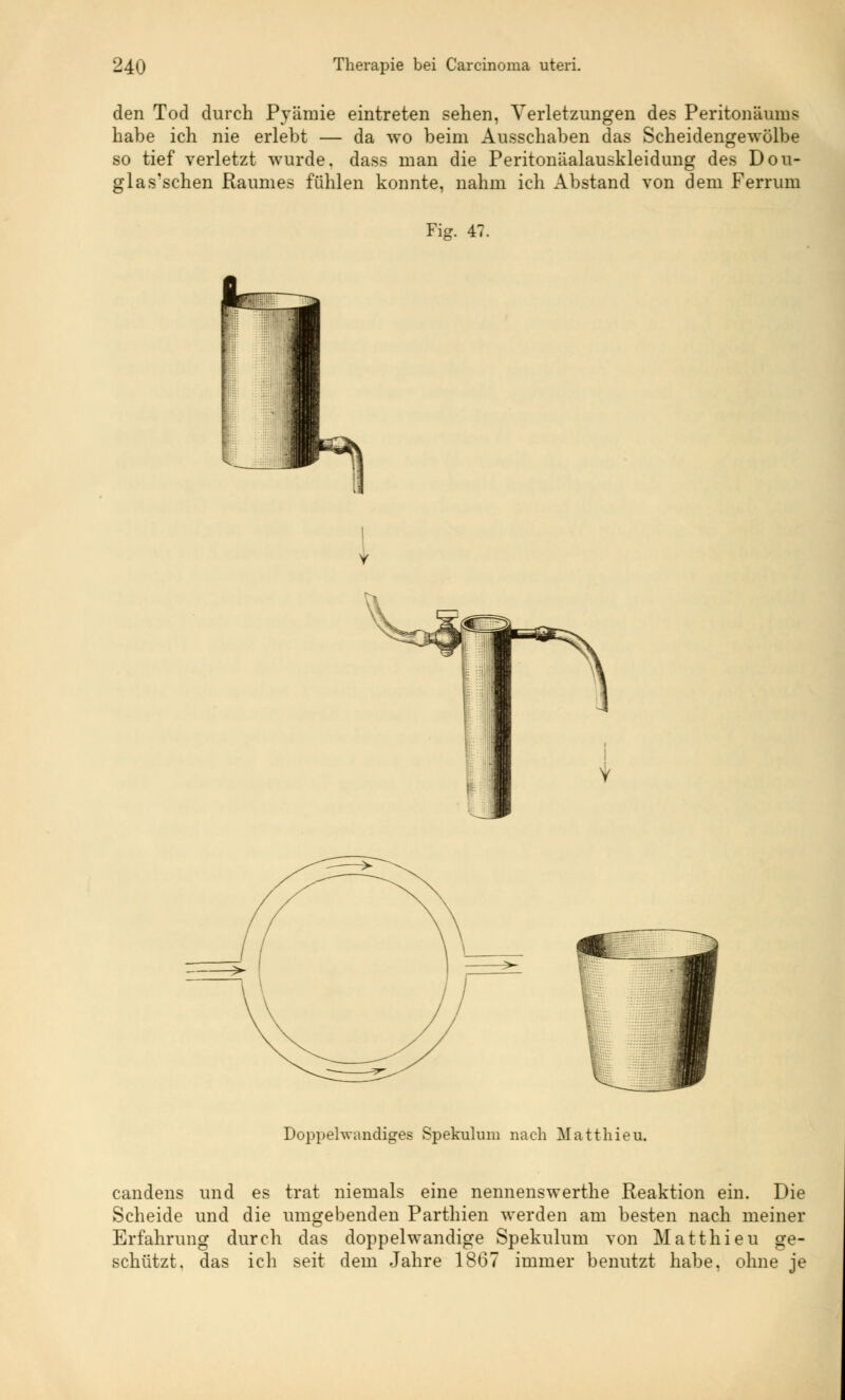 den Tod durch Prämie eintreten sehen, Verletzungen des Peritoneums habe ich nie erlebt — da wo beim Ausschaben das Scheidengewülbe so tief verletzt wurde, dass man die Peritonäalauskleidung des Dou- glas'schen Raumes fühlen konnte, nahm ich Abstand von dem Ferrum Fig. 47. Doppehvandiges Spekulum nach Matthieu. candens und es trat niemals eine nennenswerthe Reaktion ein. Die Scheide und die umgebenden Parthien werden am besten nach meiner Erfahrung durch das doppelwandige Spekulum von Matthieu ge- schützt, das ich seit dem Jahre 1867 immer benutzt habe, ohne je