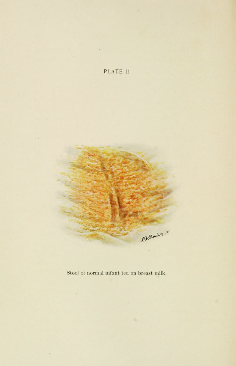 PLATE II ii'1 Stool of normal infant fed on breast milk.