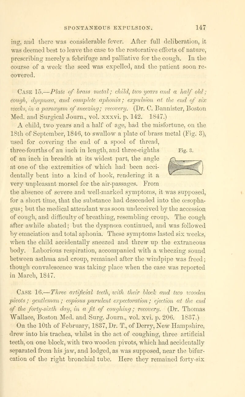ing, and there was considerable fever. After full deliberation, it was deemed best to leave the case to the restorative efforts of nature, prescribing merely a febrifuge and palliative for the cough. In the course of a week the seed was expelled, and the patient soon re- covered. Case 15.—Plate of brass metal; child, two years and a half old; cough, dyspnoea, and complete aphonia; expulsion at the end of six weeks, in a paroxysm of sneezing; recovery. (Dr. C. Bannister, Boston Med. and Surgical Journ., vol. xxxvi. p. 142. 1S47.) A child, two years and a half of age, had the misfortune, on the 18th of September, 1846, to swallow a plate of brass metal (Fig. 3), used for covering the end of a spool of thread, three-fourths of an inch in length, and three-eighths Fig. 3. of an inch in breadth at its widest part, the angle at one of the extremities of which had been acci- dentally bent into a kind of hook, rendering it a very unpleasant morsel for the air-passages. From the absence of severe and well-marked symptoms, it was supposed, for a short time, that the substance had descended into the oesopha- gus ; but the medical attendant was soon undeceived by the accession of cough, and difficulty of breathing, resembling croup. The cough after awhile abated; but the dyspnoea continued, and was followed by emaciation and total aphonia. These symptoms lasted six weeks, when the child accidentally sneezed and threw up the extraneous body. Laborious respiration, accompanied with a wheezing sound between asthma and croup, remained after the windpipe was freed; though convalescence was taking place when the case was reported in March, 1847. Case 16.—Three artificial teeth, icith their block and two zcooden pivots; gentleman; copious purulent expectoration; ejection at the end of the forty-sixth day, in a fit of coughing; recovery. (Dr. Thomas Wallace, Boston Med. and Surg. Journ., vol. xvi. p. 206. 1887.) On the 10th of February, 1837, Dr. T., of Derry, New Hampshire, drew into his trachea, whilst in the act of coughing, three artificial teeth, on one block, with two wooden pivots, which had accidentally separated from his jaw, and lodged, as was supposed, near the bifur- cation of the right bronchial tube. Here they remained forty-six