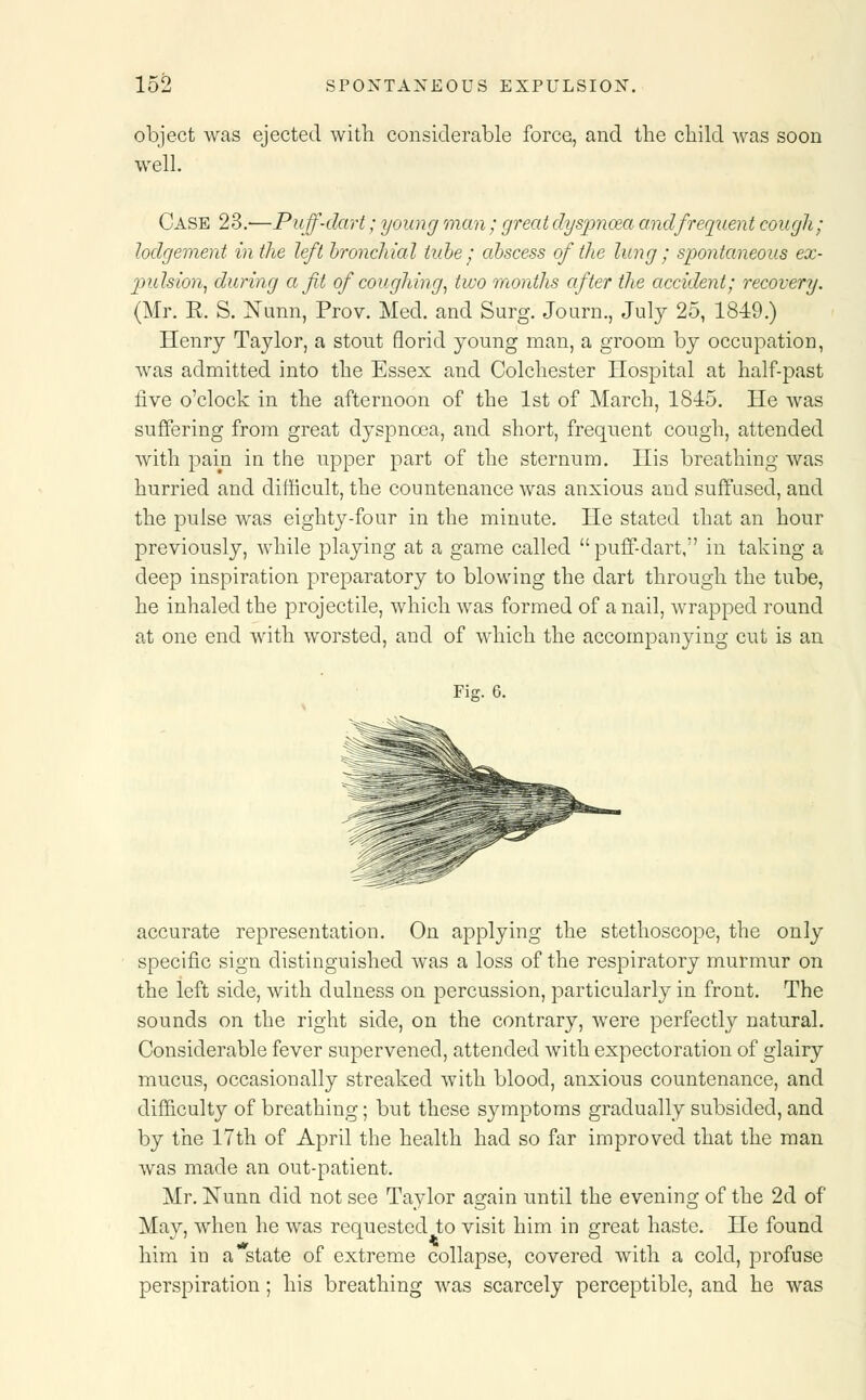 object was ejected with considerable force, and the child was soon well. Case 23.—Puff-dart; young man; great dyspnoea and frequent cough; lodgement in the left bronchial tube ; abscess of the lung ; spontaneous ex- 'pulsion, during a fit of coughing, two months after the accident; recovery. (Mr. E. S. Nunn, Prov. Med. and Surg. Journ., July 25, 1849.) Henry Taylor, a stout florid young man, a groom by occupation, was admitted into the Essex and Colchester Hospital at half-past five o'clock in the afternoon of the 1st of March, 1845. He was suffering from great dyspnoea, and short, frequent cough, attended with pain in the upper part of the sternum. His breathing was hurried and difficult, the countenance was anxious and suffused, aud the pulse was eighty-four in the minute. He stated that an hour previously, while playing at a game called puff-dart, in taking a deep inspiration preparatory to blowing the dart through the tube, he inhaled the projectile, which was formed of a nail, wrapped round at one end with worsted, and of which the accompanying cut is an Fig. 6. accurate representation. On applying the stethoscope, the only specific sign distinguished was a loss of the respiratory murmur on the left side, with dulness on percussion, particularly in front. The sounds on the right side, on the contrary, were perfectly natural. Considerable fever supervened, attended with expectoration of glairy mucus, occasionally streaked with blood, anxious countenance, and difficulty of breathing; but these symptoms gradually subsided, and by the 17th of April the health had so far improved that the man was made an out-patient. Mr. Nunn did not see Taylor again until the evening of the 2d of May, when he was requested to visit him in great haste. He found him in a state of extreme collapse, covered with a cold, profuse perspiration; his breathing was scarcely perceptible, and he was