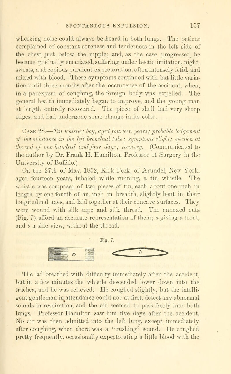 wheezing noise could always be heard in both lungs. The patient complained of constant soreness and tenderness in the left side of the chest, just below the nipple; and, as the case progressed, he became gradually emaciated, suffering under hectic irritation, night- sweats, and copious purulent expectoration, often intensely fetid, and mixed with blood. These symptoms continued with but little varia- tion until three months after the occurrence of the accident, when, in a paroxysm of coughing, the foreign body was expelled. The general health immediately began to improve, and the young man at length entirely recovered. The piece of shell had very sharp edges, and had undergone some change in its color. Case 28.—Tin whistle; boy, aged fourteen years; probable lodgement of tihe substance in the left bronchial tube; symptoms sliglit; ejection at the end of one hundred and four days; recovery. (Communicated to the author by Dr. Frank H. Hamilton, Professor of Surgery in the University of Buffalo.) On the 27th of May, 1852, Kirk Peck, of Arundel, New York, aged fourteen years, inhaled, while running, a tin whistle. The whistle was composed of two pieces of tin, each about one inch in length by one fourth of an inch in breadth, slightly bent in their longitudinal axes, and laid together at their concave surfaces. They were wound with silk tape and silk thread. The annexed cuts (Fig. 7), afford an accurate representation of them; a giving a front, and b a side view, without the thread. Fig. 7. ^ CO The lad breathed with difficulty immediately after the accident, but in a few minutes the whistle descended lower down into the trachea, and he was relieved. He coughed slightly, but the intelli- gent gentleman in attendance could not, at first, detect any abnormal sounds in respiration, and the air seemed to pass freely into both lungs. Professor Hamilton saw him five days after the accident. No air was then admitted into the left lung, except immediately after coughing, when there was a  rushing sound. He coughed pretty frequently, occasionally expectorating a little blood with the