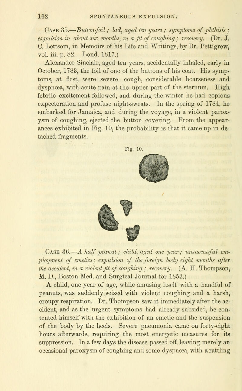 Case 35.—Button-foil; lad, aged ten years ; symptoms of phthisis ; expulsion in about six months, in a fit of coughing; recovery. (Dr. J. C. Lettsom, in Memoirs of his Life and Writings, by Dr. Pettigrew, vol. iii. p. 82. Lond. 1817.) Alexander Sinclair, aged ten years, accidentally inhaled, early in October, 1783, the foil of one of the buttons of his coat. His symp- toms, at first, were severe cough, considerable hoarseness and dyspnoea, with acute pain at the upper part of the sternum. High febrile excitement followed, and during the winter he had copious expectoration and profuse night-sweats. In the spring of 1784, he embarked for Jamaica, and during the voyage, in a violent parox- ysm of coughing, ejected the button covering. From the appear- ances exhibited in Fig. 10, the probability is that it came up in de- tached fragments. Fig. 10. Case 36.—A half peanut; child, aged one year; unsuccessful em- ployment of emetics; expulsion of the foreign body eight months after the accident, in a violent fit of coughing ; recovery. (A. H. Thompson, M. D., Boston Med. and Surgical Journal for 1853.) A child, one year of age, while amusing itself with a handful of peanuts, was suddenly .seized with violent coughing and a harsh, croupy respiration. Dr. Thompson saw it immediately after the ac- cident, and as the urgent symptoms had already subsided, he con- tented himself witli the exhibition of an emetic and the suspension of the body by the heels. Severe pneumonia came on forty-eight hours afterwards, requiring the most energetic measures for its suppression. In a few days the disease passed off, leaving merely an occasional paroxysm of coughing and some dyspnoea, with a rattling