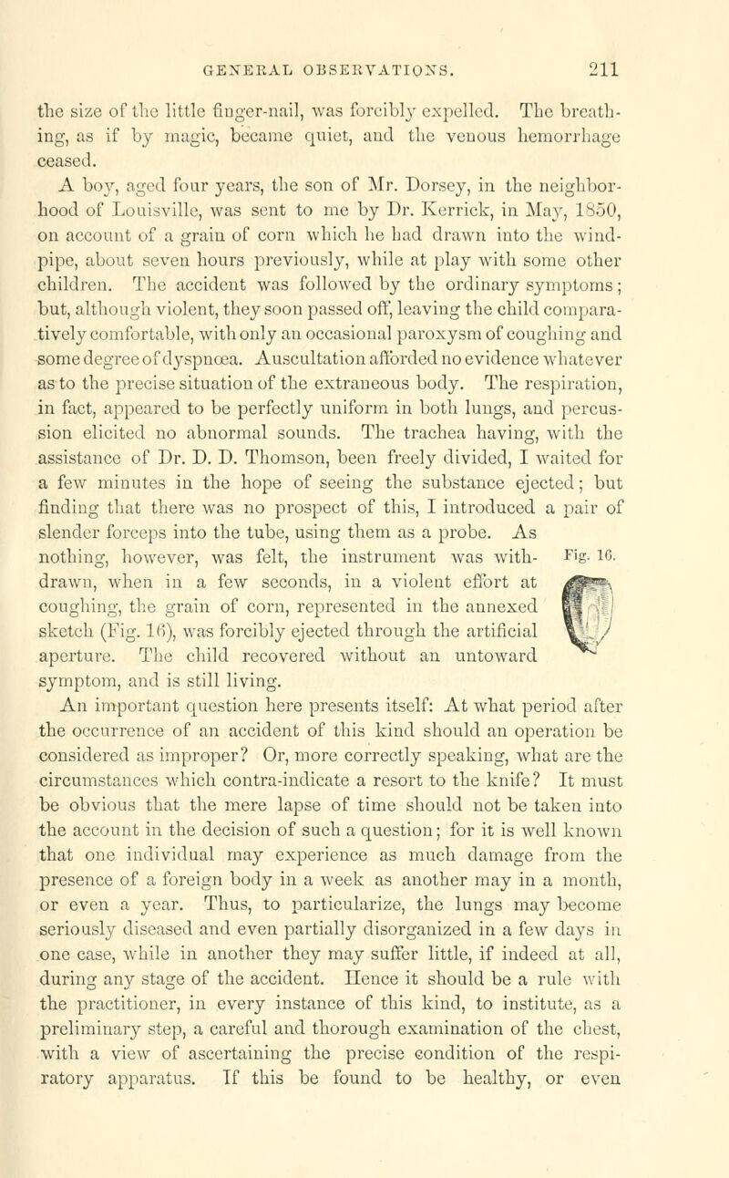the size of the little finger-nail, was forcibly expelled. The breath- ing, as if by magic, became quiet, and the venous hemorrhage ceased. A boy, aged four years, the son of Mr. Dorsey, in the neighbor- hood of Louisville, was sent to me by Dr. Kerrick, in May, 1850, on account of a grain of corn which he had drawn into the wind- pipe, about seven hours previously, while at play with some other children. The accident was followed by the ordinary symptoms; but, although violent, they soon passed off', leaving the child compara- tively comfortable, with only an occasional paroxysm of coughing and some degree of dyspnoea. Auscultation afforded no evidence whatever as to the precise situation of the extraneous body. The respiration, in fact, appeared to be perfectly uniform in both lungs, and percus- sion elicited no abnormal sounds. The trachea having, with the assistance of Dr. D. D. Thomson, been freely divided, I waited for a few minutes in the hope of seeing the substance ejected; but finding that there was no prospect of this, I introduced a pair of slender forceps into the tube, using them as a probe. As nothing, however, was felt, the instrument was with- Fig. 16. drawn, when in a few seconds, in a violent effort at coughing, the grain of corn, represented in the annexed sketch (Fig. 16), was forcibly ejected through the artificial aperture. The child recovered without an untoward symptom, and is still living. An important question here presents itself: At what period after the occurrence of an accident of this kind should an operation be considered as improper? Or, more correctly speaking, what are the circumstances which contra-indicate a resort to the knife? It must be obvious that the mere lapse of time should not be taken into the account in the decision of such a question; for it is well known that one individual may experience as much damage from the presence of a foreign body in a week as another may in a month, or even a year. Thus, to particularize, the lungs may become seriously diseased and even partially disorganized in a few days in one case, while in another they may suffer little, if indeed at all, during any stage of the accident. Hence it should be a rule with the practitioner, in every instance of this kind, to institute, as a preliminary step, a careful and thorough examination of the chest, with a view of ascertaining the precise condition of the respi- ratory apparatus. If this be found to be healthy, or even