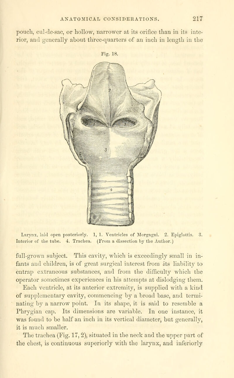poncli, cul-de-sac, or hollow, narrower at its orifice than in its inte- rior, and generally about three-quarters of an inch in length in the Fig. 18. Larynx, laid open posteriorly. 1, 1. Ventricles of Morgagni. 2. Epiglottis. 3. Interior of the tube. 4. Trachea. (From a dissection by the Author.) full-grown subject. This cavity, which is exceedingly small in in- fants and children, is of great surgical interest from its liability to entrap extraneous substances, and from the difficulty which the operator sometimes experiences in his attempts at dislodging them. Each ventricle, at its anterior extremity, is supplied with a kind of supplementary cavity, commencing by a broad base, and termi- nating by a narrow point. In its shape, it is said to resemble a Phrygian cap. Its dimensions are variable. In one instance, it was found to be half an inch in its vertical diameter, but generally, it is much smaller. The trachea (Fig. 17, 2), situated in the neck and the upper part of the chest, is continuous superiorly with the larynx, and inferiorly