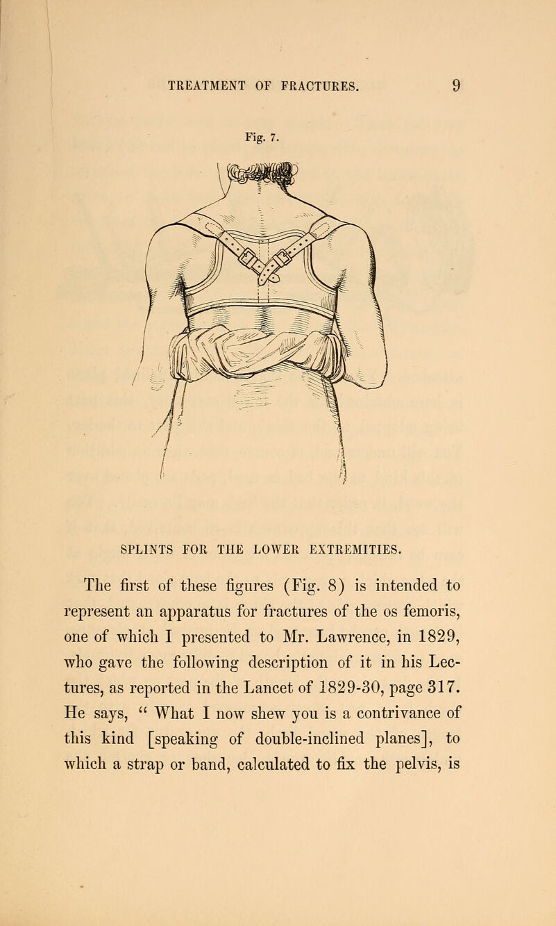 Fig. 7. SPLINTS FOR THE LOWER EXTREMITIES. The first of these figures (Fig. 8) is intended to represent an apparatus for fractures of the os femoris, one of which I presented to Mr. Lawrence, in 1829, who gave the following description of it in his Lec- tures, as reported in the Lancet of 1829-30, page 317. He says,  What I now shew you is a contrivance of this kind [speaking of double-inclined planes], to which a strap or band, calculated to fix the pelvis, is