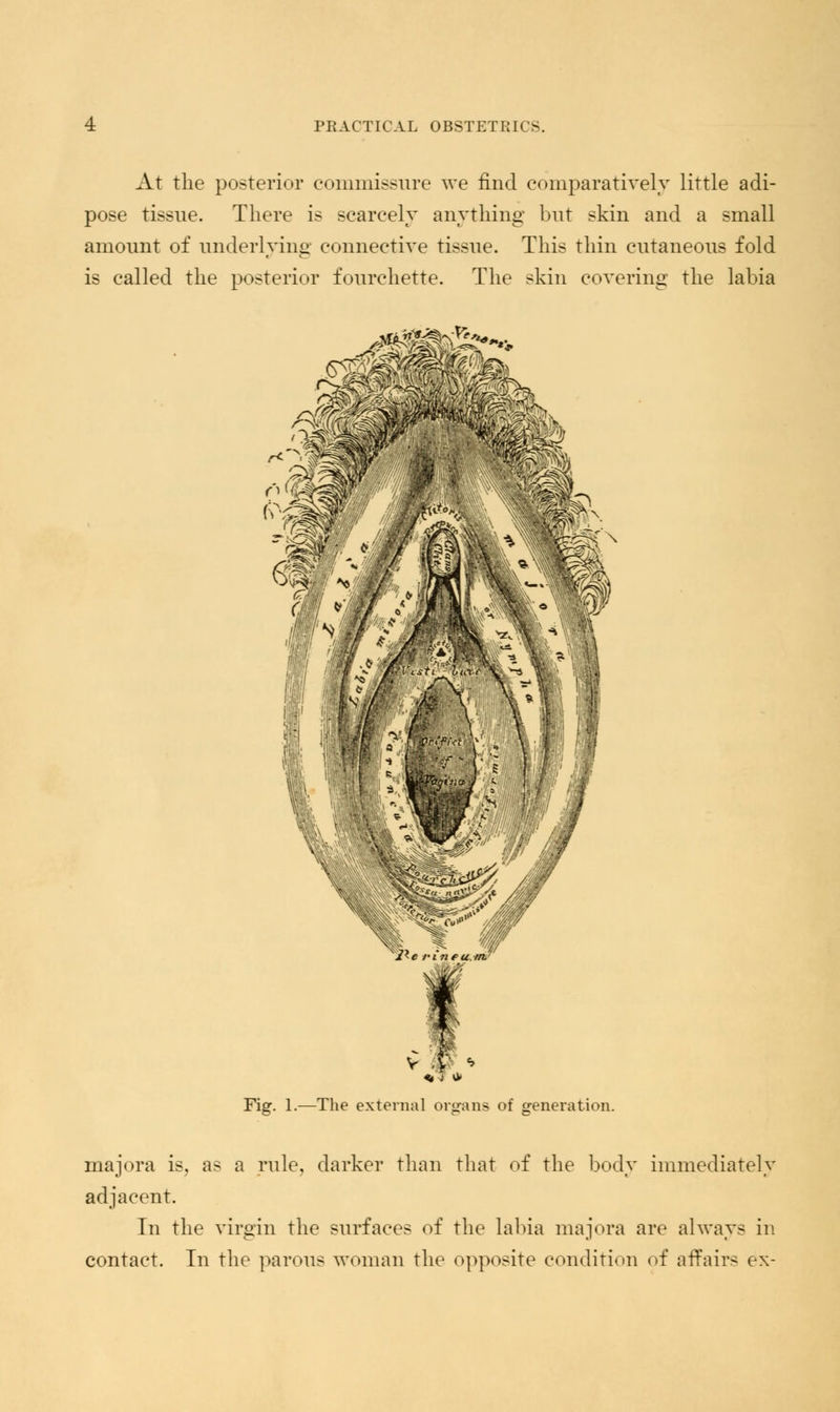 At the posterior commissure we find comparatively little adi- pose tissue. There is scarcely anything but skin and a small amount of underlying connective tissue. This thin cutaneous fold is called the posterior fourchette. The skin covering the labia Fig. 1.—The external organs of generation. majora is, as a rule, darker than that of the body immediately adjacent. In the virgin the surfaces of the labia majora are always in contact. In the parous woman the opposite condition of affairs ex-