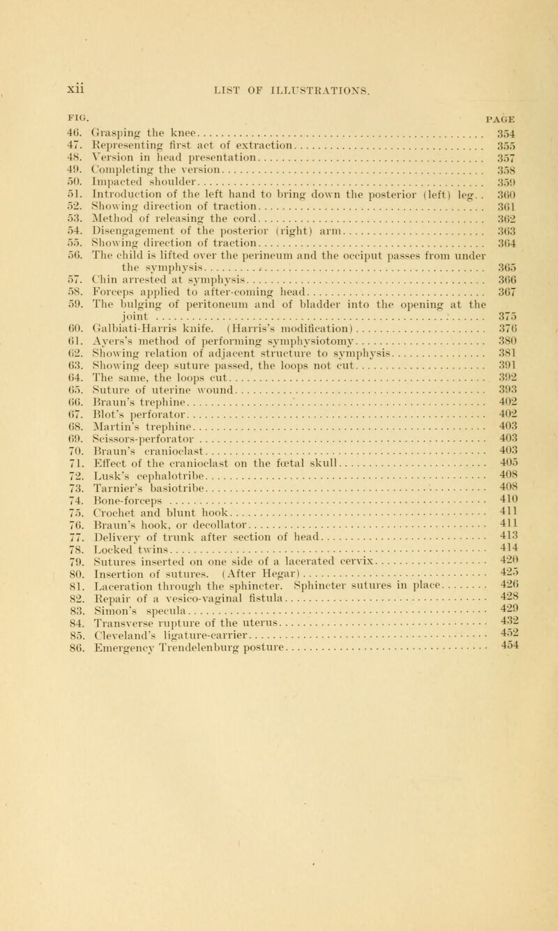 FIG. PAGE 40. Grasping the knee 354 47. Representing first act of extraction 355 48. Version in head presentation 357 49. Completing the version 358 50. Impacted shoulder 359 51. Introduction of the left hand to bring down the posterior (left) leg. . 360 52. Showing direction of traction 361 53. Method of releasing the cord 362 54. Disengagement of the posterior (right) arm 363 ^>r>. Showing direction of traction 304 50. The child is lifted over the perineum and the occiput passes from under the symphysis 305 57. Chin arrested at symphysis 300 58. Forceps applied to after-coming head 307 59. The bulging of peritoneum and of bladder into the opening at the joint 375 00. Galbiati-Harris knife. ( Harris's modification) 370 61. Ayers's method of performing symphysiotomy 3S0 02. Showing relation of adjacent structure to symphysis 381 03. Showing deep suture passed, the loops not cut 391 04. The same, the loops cut 392 65. Suture of uterine wound 303 00. Braun's trephine 402 07. Rlofs perforator 402 08. Martin's trephine 403 69. Scissors-perforator 403 70. Braun's cranioclast 403 71. Effect of the cranioclast on the foetal skull 405 72. Lusk's cephalotribe 408 73. Tarnier's basiotribe 408 74. Bone-forceps 410 75. Crochet and blunt hook 411 70. Braun's hook, or decollator 411 77. Delivery of trunk after section of head 413 78. Locked'twins 414 79. Sutures inserted on one side of a lacerated cervix 428 80. Insertion of sutures. (After Hegar) 425 81. Laceration through the sphincter. Sphincter sutures in place 420 82. Repair of a vesico-vaginal fistula 428 83. Simon's specula 429 84. Transverse rupture of the uterus 432 85. Cleveland's ligature-carrier 452 80. Emergency Trendelenburg posture 454