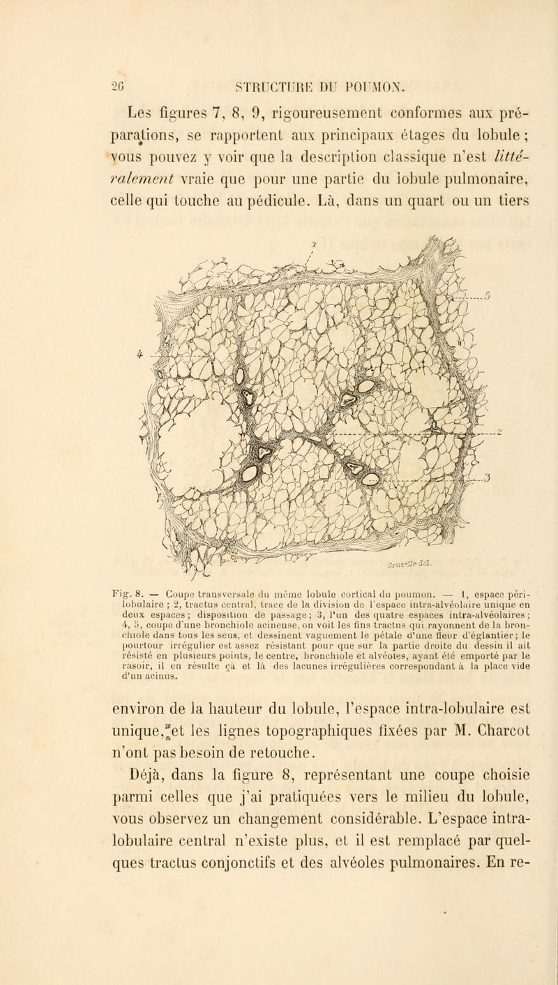 Les figures 7, 8, 9, rigoureusement conformes aux pré- parations, se rapportent aux principaux étages du lobule ; vous pouvez y voir que la description classique n'est litté- ralement vraie que pour une partie du lobule pulmonaire, celle qui touche au pédicule. Là, dans un quart ou un tiers Fig. 8. — Coupe transversale .du même lobule cortical du poumon. —■ 1, espacp péri- lobulaire ; ï, tractus central, tnice de la division de l'espace intra-alvéolaire unique en deux espaces; disposition de passage; 3, l'un des quatre espaces intra-alvéolaires : 4, y, coupe d'une bronchiole acineuse. on voit les fins tractus qui rayonnent de la bron- chiole dans tous les sens, et dessinent vaguement le pétale d'une fleur d'églantier; le pourtour irrégulier est assez résistant pour que sur la partie droite du dessin il ail résisté en plusieurs points, le centre, bronchiole et alvéoles, ayant été emporté par le rasoir, il en résulte ça et là des lacunes irrégulières correspondant à la place vide d'un acinus. environ de la hauteur du lobule, l'espace intra-lobulaire est unique,et les lignes topographiques fixées par M. Charcot n'ont pas besoin de retouche. Déjà, dans la figure 8, représentant une coupe choisie parmi celles que j'ai pratiquées vers le milieu du lobule, vous observez un changement considérable. L'espace intra- lobulaire central n'existe plus, et il est remplacé par quel- ques tractus conjonctifs et des alvéoles pulmonaires. En re-