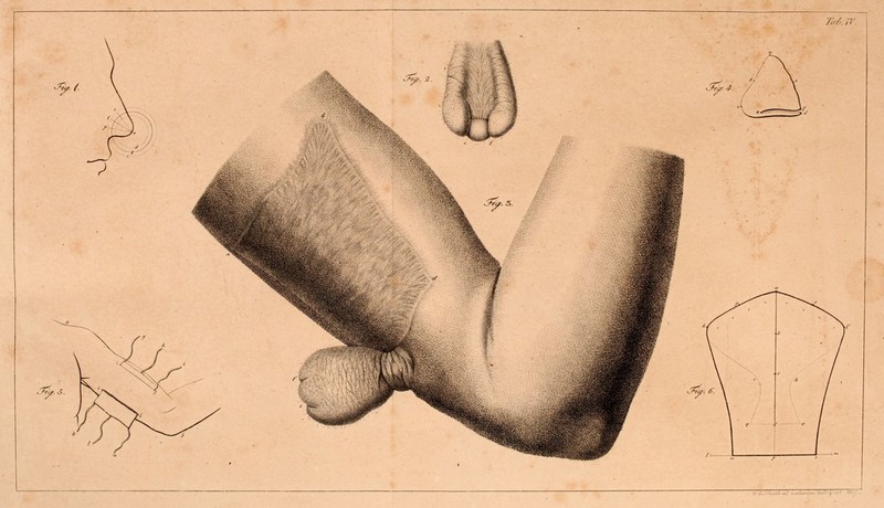 No text description is available for this image