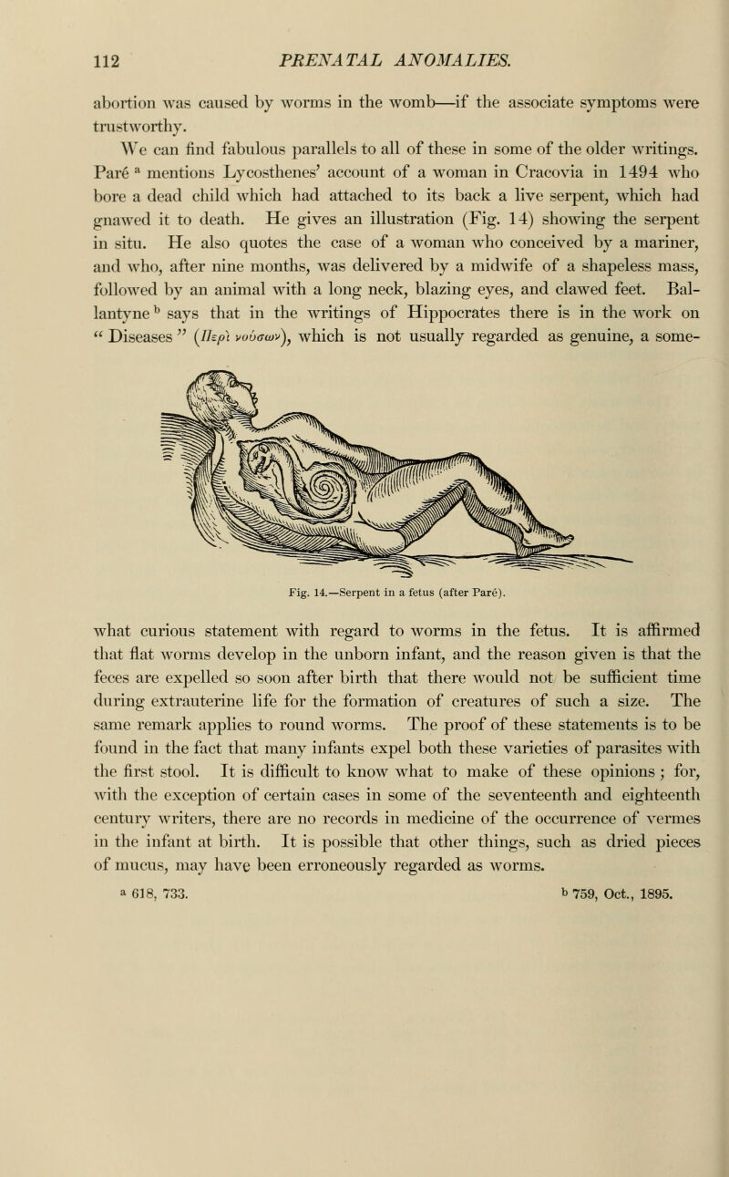 abortion was caused by worms in the womb—if the associate symptoms were trustworthy. We can find fabulous parallels to all of these in some of the older writings. Pare a mentions Lycosthenes' account of a woman in Cracovia in 1494 who bore a dead child which had attached to its back a live serpent, which had gnawed it to death. He gives an illustration (Fig. 14) showing the serpent in situ. He also quotes the case of a woman who conceived by a mariner, and who, after nine months, was delivered by a midwife of a shapeless mass, followed by an animal with a long neck, blazing eyes, and clawed feet. Bal- lantyneb says that in the writings of Hippocrates there is in the work on  Diseases  {Ihp\ vobauiv), which is not usually regarded as genuine, a some- Fig. 14.—Serpent in a fetus (after Pare). what curious statement with regard to worms in the fetus. It is affirmed that flat worms develop in the unborn infant, and the reason given is that the feces are expelled so soon after birth that there would not be sufficient time during extrauterine life for the formation of creatures of such a size. The same remark applies to round worms. The proof of these statements is to be found in the fact that many infants expel both these varieties of parasites with the first stool. It is difficult to know what to make of these opinions ; for, with the exception of certain cases in some of the seventeenth and eighteenth century writers, there are no records in medicine of the occurrence of vermes in the infant at birth. It is possible that other things, such as dried pieces of mucus, may have been erroneously regarded as worms. a 618, 733. b 759, Oct., 1895.