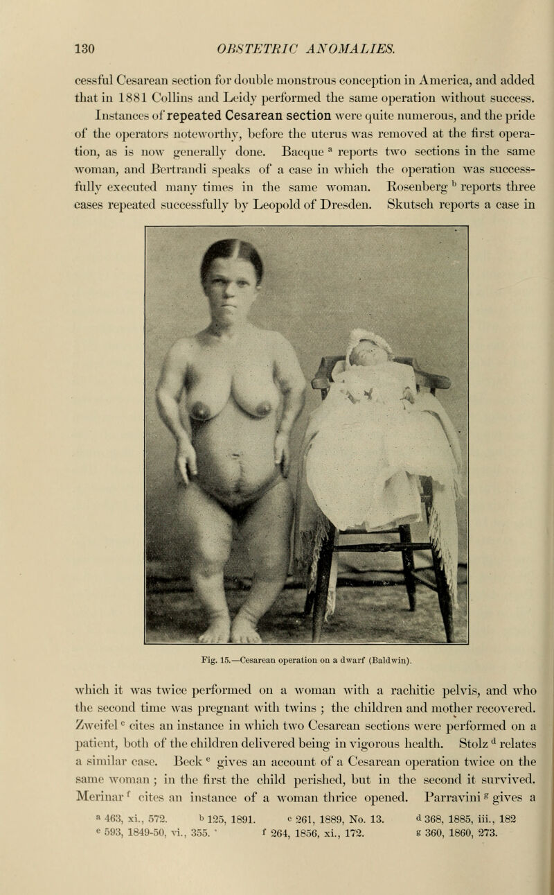 cessful Cesarean section for double monstrous conception in America, and added that in 1881 Collins and Leidy performed the same operation without success. Instances of repeated Cesarean section were quite numerous, and the pride of the operators noteworthy, before the uterus was removed at the first opera- tion, as is now generally done. Bacque a reports two sections in the same woman, and Bertrandi speaks of a case in Avhich the operation was success- fully executed many times in the same woman. Rosenberg b reports three eases repeated successfully by Leopold of Dresden. Skutsch reports a case in Fig. 15.—Cesarean operation on a dwarf (Baldwin). which it was twice performed on a woman with a rachitic pelvis, and who the second time was pregnant with twins ; the children and mother recovered. Zweifelc cites an instance in which two Cesarean sections were performed on a patient, both of the children delivered being in vigorous health. Stolz d relates a similar case. Beck e gives an account of a Cesarean operation twice on the same woman ; in the first the child perished, but in the second it survived. Merinar l cites an instance of a woman thrice opened. Parravinig gives a a 463, xi., 572. b 125, 1891. c 261, 1889, No. 13. d 368, 1885, iii., 182 e 593, 1849-50, vi., 355. * f 264, 1856, xi., 172. S 360, 1860, 273. 1