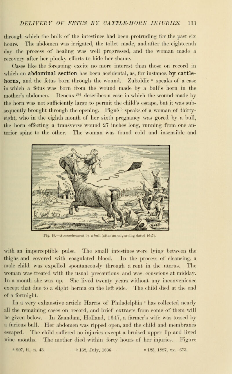 through which the bulk of the intestines had been protruding for the past six hours. The abdomen was irrigated, the toilet made, and after the eighteenth day the process of healing was well progressed, and the woman made a recovery after her plucky efforts to hide her shame. Cases like the foregoing excite no more interest than those on record in which an abdominal section has been accidental, as, for instance, by cattle- horns, and the fetus born through the wound. Zuboldie a speaks of a case in which a fetus was born from the wound made by a bulPs horn in the mother's abdomen. Deneux294 describes a case in which the wound made by the horn was not sufficiently large to permit the child's escape, but it was sub- sequently brought through the opening. Pigne b speaks of a woman of thirty- eight, who in the eighth month of her sixth pregnancy was gored by a bull, the horn effecting a transverse wound 27 inches long, running from one an- terior spine to the other. The woman was found cold and insensible and Fig. 19.—Accouchement by a hull (alter an engraving dated 1647). with an imperceptible pulse. The small intestines were lying between the thighs and covered with coagulated blood. In the process of cleansing, a male child was expelled spontaneously through a rent in the uterus. The woman was treated with the usual precautions and was conscious at midday. In a month she was up. She lived twenty years without any inconvenience except that due to a slight hernia on the left side. The child died at the end of a fortnight. In a very exhaustive article Harris of Philadelphia c has collected nearly all the remaining cases on record, and brief extracts from some of them will be given below. In Zaandam, Holland, 1647, a farmer's wife was tossed by a furious bull. Her abdomen was ripped open, and the child and membranes escaped. The child suffered no injuries except a bruised upper lip and lived nine months. The mother died within forty hours of her injuries. Figure a 297, ii., n. 43. b 162, July, 1836. c 125, 1887, xx„ 673.