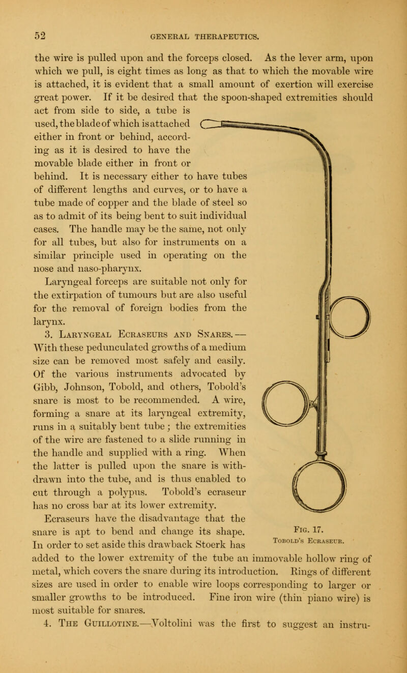 the wire is pulled upon and the forceps closed. As the lever arm, upon which we pull, is eight times as long as that to which the movable wire is attached, it is evident that a small amount of exertion will exercise great power. If it be desired that the spoon-shaped extremities should act from side to side, a tube is used, the blade of which is attached either in front or behind, accord- ing as it is desired to have the movable blade either in front or behind. It is necessary either to have tubes of different lengths and curves, or to have a tube made of copper and the blade of steel so as to admit of its being bent to suit individual cases. The handle may be the same, not only for all tubes, but also for instruments on a similar principle used in operating on the nose and naso-pharynx. Laryngeal forceps are suitable not only for the extirpation of tumours but are also useful for the removal of foreign bodies from the larynx. 3. Laryngeal Ecraseurs and Snares.— With these pedunculated growths of a medium size can be removed most safely and easily. Of the various instruments advocated by Gibb, Johnson, Tobold, and others, Tobold's snare is most to be recommended. A wire, forming a snare at its laryngeal extremity, runs in a suitably bent tube ; the extremities of the wire are fastened to a slide running in the handle and supplied with a ring. When the latter is pulled upon the snare is with- drawn into the tube, and is thus enabled to cut through a polypus. Tobold's ecraseur has no cross bar at its lower extremity. Ecraseurs have the disadvantage that the snare is apt to bend and change its shape. In order to set aside this drawback Stoerk has added to the lower extremity of the tube an immovable hollow ring of metal, which covers the snare during its introduction. Rings of different sizes are used in order to enable wire loops corresponding to larger or smaller growths to be introduced. Fine iron wire (thin piano wire) is most suitable for snares. •4. The Guillotine.—Yoltolini was the first to sua-o-est an instru- Fig. 17. Tobold's Ecraseur.