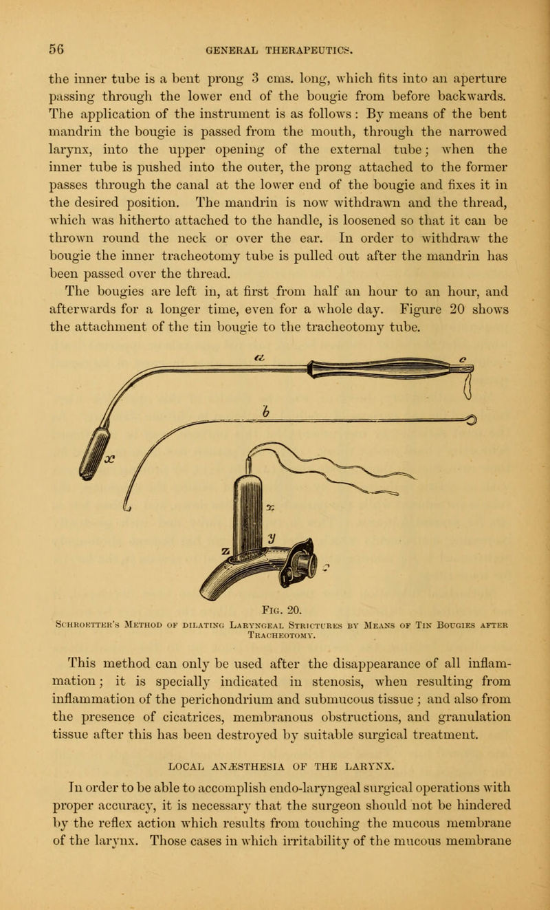 the inner tube is a bent prong 3 cms. long, which fits into an aperture passing through the lower end of the bougie from before backwards. The application of the instrument is as follows : By means of the bent mandrin the bougie is passed from the mouth, through the narrowed larynx, into the upper opening of the external tube; when the inner tube is pushed into the outer, the prong attached to the former passes through the canal at the lower end of the bougie and fixes it in the desired position. The mandrin is now withdrawn and the thread, which was hitherto attached to the handle, is loosened so that it can be thrown round the neck or over the ear. In order to withdraw the bougie the inner tracheotomy tube is pulled out after the mandrin has been passed over the thread. The bougies are left in, at first from half an hour to an hour, and afterwards for a longer time, even for a whole day. Figure 20 shows the attachment of the tin bougie to the tracheotomy tube. Fig. 20. Schroetter's Method of dilating Laryngeal Strictures by Tracheotomy. Mea of Tin Bougies after This method can only be used after the disappearance of all inflam- mation ; it is specially indicated in stenosis, when resulting from inflammation of the perichondrium and submucous tissue ; and also from the presence of cicatrices, membranous obstructions, and granulation tissue after this has been destroyed by suitable surgical treatment. LOCAL ANAESTHESIA OF THE LARYNX. In order to be able to accomplish endo-laryngeal surgical operations with proper accuracy, it is necessary that the surgeon should not be hindered by the reflex action which results from touching the mucous membrane of the larynx. Those cases in which irritability of the mucous membrane