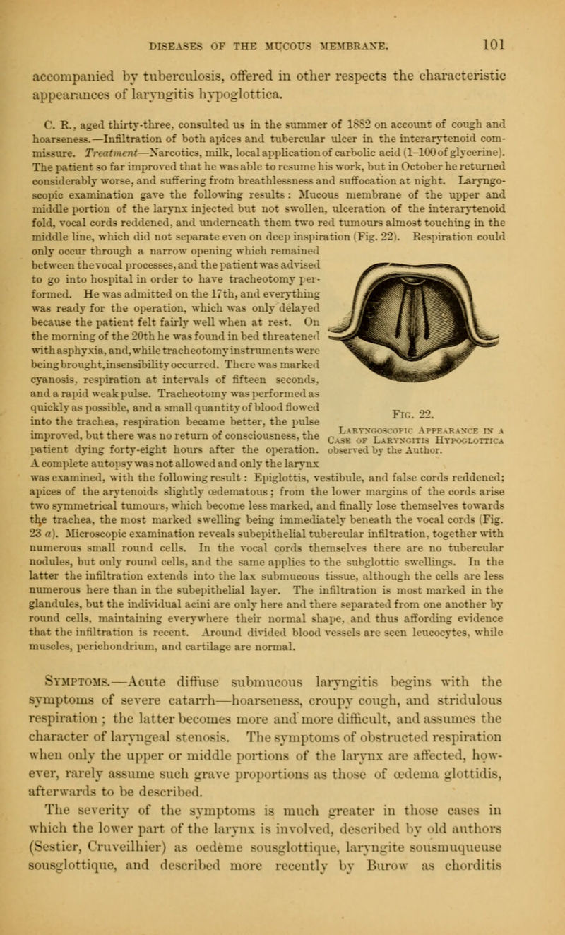 impanied by tuberculosis, offered in other respects the characteristic appearances of laryngitis hypoglottica, C. E.. aged thirty-three, consulted us in the summer of 1882 on account of cough and hoarseness.—Infiltration of both apices and tubercular ulcer in the interarytenoid com- re. Treatment—Narcotics, milk, local application of carbolic acid (1-100 of glycerine . The patient so far improved that he was able to resume his work, but in October he returned considerably worse, and suffering from breathlessness and suffocation at night. Laryngo- scopy examination gave the following results : Mucous membrane of the upper and middle portion of the larynx injected but not swollen, ulceration of the interarytenoid fold, vocal cords reddened, and underneath them two red tumours almost touching in the middle line, which did not separate even on deep inspiration i Fig. 22 . Respiration could only occur through a narrow opening which remained between the vocal procenocn, and the patient was adv. to go into hospital in order to have tracheotomy \ ^i - formed. He was admitted on the 17th, and everything was ready for the operation, which was only delayed because the patient felt fairly well when at rest. On the morning of the 20th he was found in bed threatened with asphyxia, and, while tracheotomy instruments were being brought.insensibility occurred. There was marked cyanosis, respiration at intervals of fifteen seconds. and a rapid weak pulse. Tracheotomy was performed a> quickly as possible, and a small quantity of blood flowed 00 into the trachea, respiration became better, the pulse improved, but there was no return of consciousness, the c *«J2gX*J b££££o£ patient dying forty-eight hours after the operation, observed by the Author. A complete aoto] sy was not allowed and only the larynx wai examined, with the following residt : Epiglottis, vestibide. and false cords reddened: apices of the arytenoids slightly (edematous : from the lower margins of the cords arise two symmetrical tumours, which become less marked, and finally lose themselves towards th,e trachea, the most marked swelling being immediately beneath the vocal cords (Fig. . Microscopic examination reveals subepithelial tubercular infiltration, together with numerous small round cells. In the vocal cords themselves there are no tubercular nodules, but only round cells, and the same applies to the subglottic swellings. In the latter the infiltration extends into the lax submucous tissue, although the cells ai numerous here than in the subepithelial layer. The infiltration is most marked in the glandules, but the individual acini are only here and there separated from one another by round cells, maintaining everywhere their normal shape, and thus affording evidence that the infiltration is recent. Around divided blood vessels are seen leucocytes, while muscles, perichondrium, and cartilage are normal. SYMPTOMS.—Acute diffuse submucous laryngitis begins with the symptoms of severe catarrh—hoarseness, croupy cough, and striduloua respiratioo ; the latter becomes more and more difficult, and assumes the character of Laryngeal stenosis. The symptoms of obstructed respiration when <»nly the upper or middle portions of the larynx are affected, how- ever, rarely assume such grave proportions as those of oedema glottidis, afterwards to be described. The severity of the symptoms is much -rearer in those cases in which the lower part of the larynx is involved, described by old authors 8 stier, Cruveilhier) as oedeme sousglottique, laryngite sousmuqueuse iglottique, and described more recently by Burow as chorditis