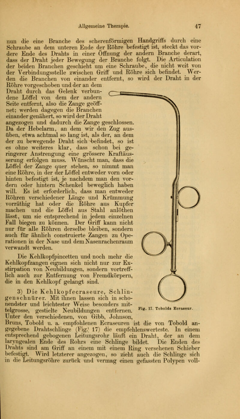 nun die eine Branche des scherenförmigen Handgriffs durch eine Schraube an dem unteren Ende der Röhre befestigt ist, steckt das vor- dere Ende des Drahts in einer Öffnung der andern Branche derart, dass der Draht jeder Bewegung der Branche folgt. Die Articulation der beiden Branchen geschieht um eine Schraube, die nicht weit von der Verbindungsstelle zwischen Griff und Röhre sich befindet. Wer- den die Branchen von emander entfernt, so wird der Draht in der Röhre vorgeschoben und der an dem Draht durch das Gelenk verbun- dene Löffel von dem der andern Seite entfernt, also die Zange geöff- net; werden dagegen die Branchen einander genähert, so wird der Draht angezogen und dadurch die Zange geschlossen. Da der Hebelarm, an dem wir den Zug aus- üben, etwa achtmal so lang ist, als der, an dem der zu bewegende Draht sich -befindet, so ist es ohne weiteres klar, dass schon bei ge- ringerer Anstrengung eine grössere Kraftäus- serung erfolgen ruuss. Wünscht man, dass die Löffel der Zange quer stehen, so nimmt man eine Röhre, in der der Löffel entweder vorn oder hinten befestigt ist, je nachdem man den vor- dem oder hintern Schenkel beweglich haben will. Es ist erforderlich, dass man entweder Röhren verschiedener Länge und Krümmung vorräthig hat oder die Röhre aus Kupfer machen und die Löffel aus Stahl anlöthen lässt, um sie entsprechend in jedem einzelnen Fall biegen zu können. Der Griff kann nicht nur für alle Röhren derselbe bleiben, sondern auch für ähnlich construierte Zangen zu Ope- rationen in der Nase und dem Nasenrachenraum verwandt werden. Die Kehlkopfpincetten und noch mehr die Kehlkopfzangen eignen sich nicht nur zur Ex- stirpation von Neubildungen, sondern vortreff- lich auch zur Entfernung von Fremdkörpern, die in den Kehlkopf gelangt sind. 3) Die Kehlkopfecraseure, Schlin- gen schnür er. Mit ihnen lassen sich in scho- nendster und leichtester Weise besonders mit- telgrosse, gestielte Neubildungen entfernen. Unter den verschiedenen, von Gibb, Johnson, Bruns, Tobold u. a. empfohlenen Ecraseuren ist die von Tobold an- ^'t'tfebene Drahtschlinge (Fig.] 17) die empfehlenswerteste. In einem »Mitsprechend gebogenen Leitungsrohr läuft ein Draht, der an dein lurvngealen Ende des Rohrs eine Schlinge bildet. Die Enden des Drahts sind am Griff an einem mit einem Ring versehenen Schieber befestigt. Wird letzterer angezogen, so zieht auch die Schlinge sich in die Leitungsröhre zurück und vermag einen gefassten Polypen voll' Fig. 17. Tobolde Ecraseur.