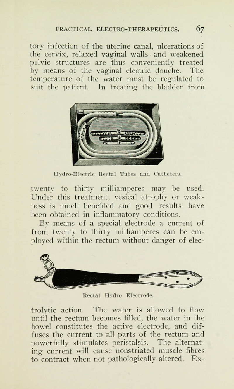 tory infection of the uterine canal, ulcerations of the cervix, relaxed vaginal walls and weakened pelvic structures are thus conveniently treated by means of the vaginal electric douche. The temperature of the water must be regulated to suit the patient. In treating the bladder from ll.vdro-EI Rectal Tulies and Catheters. twenty to thirty milliamperes may be used. Under this treatment, vesical atrophy or weak- ness is much benefited and good results have been obtained in inflammatory conditions. By means of a special electrode a current of from twenty to thirty milliamperes can be em- ployed within the rectum without clanger of elec- Rectal Hydro Electrode. trolytic action. The water is allowed to flow until the rectum becomes filled, the water in the bowel constitutes the active electrode, and dif- fuses the current to all parts of the rectum and powerfully stimulates peristalsis. The alternat- ing current will cause nonstriated muscle fibres to contract when not pathologically altered. Ex-