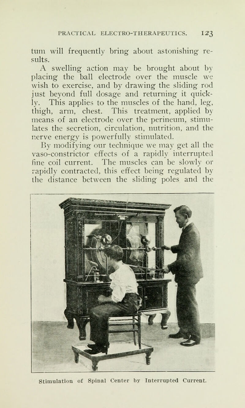 turn will frequently bring about astonishing re- sults. A swelling action may be brought about by placing the ball electrode over the muscle we wish to exercise, and by drawing the sliding rod just beyond full dosage and returning it quick- ly. This applies to the muscles of the hand, leg, thigh, arm, chest. This treatment, applied b\ means of an electrode over the perineum, stimu- lates the secretion, circulation, nutrition, and the nerve energy is powerfully stimulated. By modifying our technique we may get all the vaso-constrictor effects of a rapidly interrupted fine coil current. The muscles can be slowly or rapidly contracted, this effect being regulated by the distance between the sliding poles and the Stimulation of Spinal Center by Interrupted Current.