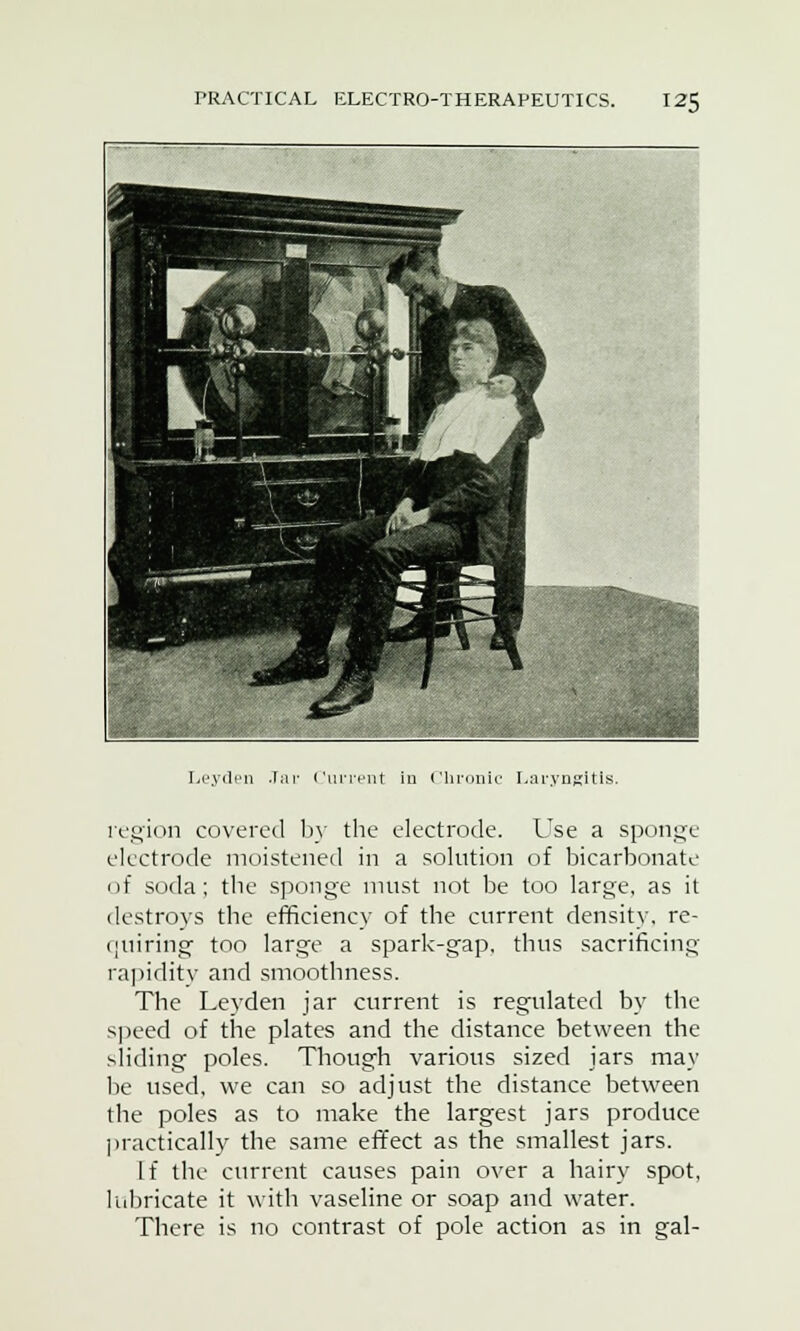 Leyden .Tar Current in Chronic Laryngitis region covered by the electrode. Use a sponge electrode moistened in a solution of bicarbonate of soda; the sponge must not be too large, as it destroys the efficiency of the current density, re- quiring too large a spark-gap. thus sacrificing rapidity and smoothness. The Leyden jar current is regulated by the speed of the plates and the distance between the sliding poles. Though various sized jars may be used, we can so adjust the distance between the poles as to make the largest jars produce practically the same effect as the smallest jars. If the current causes pain over a hairy spot, lubricate it with vaseline or soap and water. There is no contrast of pole action as in gal-
