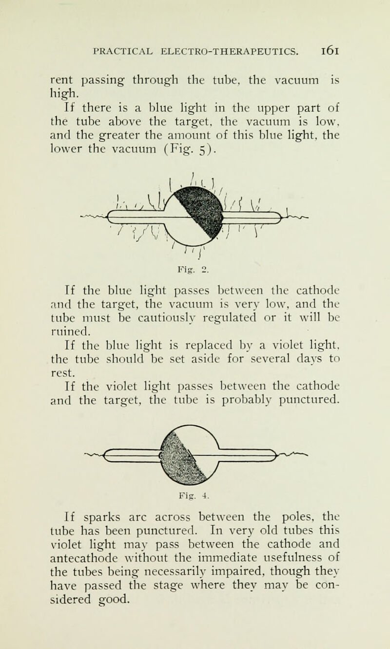 rent passing through the tube, the vacuum is high. If there is a blue light in the upper part of the tube above the target, the vacuum is low. and the greater the amount of this blue light, the lower the vacuum (Fig. 5). Fig. •>. Tf the blue light passes between the cathode and the target, the vacuum is very low, and the tube must be cautiously regulated or it will be ruined. If the blue light is replaced by a violet light. the tube should be set aside for several days to rest. If the violet light passes between the cathode and the target, the tube is probably punctured. If sparks arc across between the poles, the tube has been punctured. In very old tubes this violet light may pass between the cathode and antecathode without the immediate usefulness of the tubes being necessarily impaired, though they have passed the stage where they may be con- sidered good.