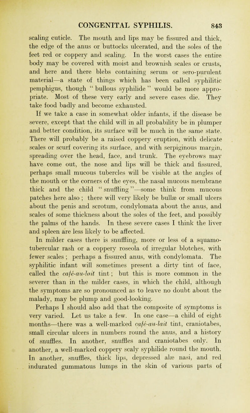 scaling cuticle. The mouth and lips may be fissured and thick, the edge of the anus or buttocks ulcerated, and the soles of the feet red or coppery and scaling. In the worst cases the entire body may be covered with moist and brownish scales or crusts, and here and there blebs containing serum or sero-purulent material—a state of things which has been called syphilitic pemphigus, though  bullous syphilide  would be more appro- priate. Most of these very early and severe cases die. They take food badly and become exhausted. If we take a case in somewhat older infants, if the disease be severe, except that the child will in all probability be in plumper and better condition, its surface will be much in the same state. There will probably be a raised coppery eruption, with delicate scales or scurf covering its surface, and with serpiginous margin, spreading over the head, face, and trunk. The eyebrows may have come out, the nose and lips will be thick and fissured, perhaps small mucous tubercles will be visible at the angles of the mouth or the corners of the eyes, the nasal mucous membrane thick and the child  snuffling—some think from mucous patches here also ; there will very likely be bullae or small ulcers about the penis and scrotum, condylomata about the anus, and scales of some thickness about the soles of the feet, and possibly the palms of the hands. In these severe cases I think the liver and spleen are less likely to be affected. In milder cases there is snuffling, more or less of a squamo- tubercular rash or a coppery roseola of irregular blotches, with fewer scales ; perhaps a fissured anus, with condylomata. The syphilitic infant will sometimes present a dirty tint of face, called the cafe-au-loit tint; but this is more common in the severer than in the milder cases, in which the child, although the symptoms are so pronounced as to leave no doubt about the malady, may be plump and good-looking. Perhaps I should also add that the composite of symptoms is very varied. Let us take a few. In one case—a child of eight months—there was a well-marked cafe-au-lait tint, craniotabes, small circular ulcers in numbers round the anus, and a history of snuffles. In another, snuffles and craniotabes only. In another, a well-marked coppery scaly syphilide round the mouth. In another, snuffles, thick lips, depressed alse nasi, and red indurated gummatous lumps in the skin of various parts of