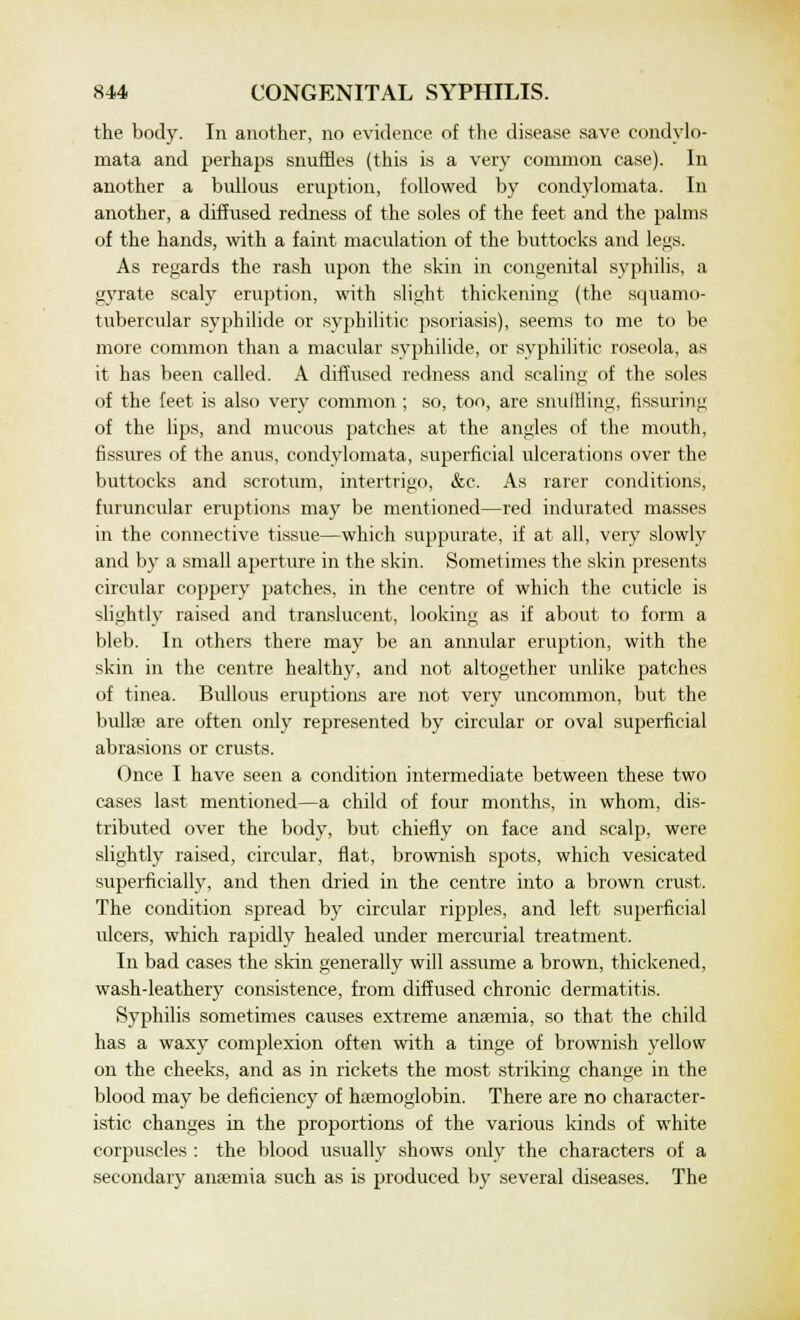 the body. In another, no evidence of the disease save condylo- mata and perhaps snuffles (this is a very common case). In another a bullous eruption, followed by condylomata. In another, a diffused redness of the soles of the feet and the palms of the hands, with a faint maculation of the buttocks and legs. As regards the rash upon the skin in congenital syphilis, a gyrate scaly eruption, with slight thickening (the squamo- tubercular syphilide or syphilitic psoriasis), seems to me to be more common than a macular syphilide, or syphilitic roseola, as it has been called. A diffused redness and scaling of the soles of the feet is also very common; so, too, are snuffling, Assuring of the lips, and mucous patches at the angles of the mouth, fissures of the anus, condylomata, superficial ulcerations over the buttocks and scrotum, intertrigo, &c. As rarer conditions, furuncular eruptions may be mentioned—red indurated masses in the connective tissue—which suppurate, if at all, very slowly and by a small aperture in the skin. Sometimes the skin presents circular coppery patches, in the centre of which the cuticle is slightly raised and translucent, looking as if about to form a bleb. In others there may be an annular eruption, with the skin in the centre healthy, and not altogether unlike patches of tinea. Bullous eruptions are not very uncommon, but the bullae are often only represented by circular or oval superficial abrasions or crusts. Once I have seen a condition intermediate between these two cases last mentioned—a child of four months, in whom, dis- tributed over the body, but chiefly on face and scalp, were slightly raised, circular, flat, brownish spots, which vesicated superficially, and then dried in the centre into a brown crust. The condition spread by circular ripples, and left superficial ulcers, which rapidly healed under mercurial treatment. In bad cases the skin generally will assume a brown, thickened, wash-leathery consistence, from diffused chronic dermatitis. Syphilis sometimes causes extreme anaemia, so that the child has a waxy complexion often with a tinge of brownish yellow on the cheeks, and as in rickets the most striking change in the blood may be deficiency of haemoglobin. There are no character- istic changes in the proportions of the various kinds of white corpuscles : the blood usually shows only the characters of a secondary anaemia such as is produced by several diseases. The