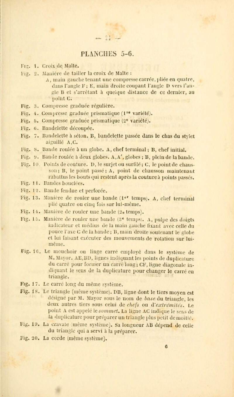 PLANCHES 5-6. |j^. 1. Croix de Malte. Fig. 2. .Manière de tailler la croix de Malte : a, main gauche tenant une compresse carrée, pliée en quatre, dans l'angle F; E, main droite coupant l'angle I) vers l'an- gle B et s'arrêtant à quelque distance de ce dernier, au point C. Compresse graduée régulière. Compresse graduée prismatique (1 variété). Compresse graduée prismatique (2e variété;. Bandelette découpée. Bandelette h séton. B, bandelette passée dans le chas du stylet aiguillé A,C. Bande roulée à un globe. A, chef terminal ; B, chef initial. Bande roulée à deux globes. A,A', globes ; B, plein de la bande. Points de couture. D, le surjet ou surlilé; C, le point de chaos- son; B, le point passé; A, point de chausson maintenant rabattus les bouts qui restent après la couture à points passés. Bandes bouclées. I ?. Bande fendue et perforée. Manière de rouler une bande (let temps). A, chef terminal plié quatre ou cinq fois sur lui-même. Manière de rouler une bande (2e temps). Manière de rouler une bande (3e temps). A, pulpe des doigts indicateur et médius de la main gauche fixant avec celle du pouce l'axe C de la bande ; B, main droite soutenant le globe et lui faisant exécuter des mouvements de rotation sur lui- même. Fig. 1C. Le mouchoir ou linge carré employé dans le système de M. May or. AE,BD, lignes indiquant les points de duplicalure du carré pour former un carré long; CF, ligne diagonale in- diquant le sens de la duplicature pour changer le carré eu triangle. Fig. 17. Le carré long du même système. Fig. ls. Le triangle (même système). DB, ligne dont le tiers moyen est désigné par M. Mayor sous le nom de base du triangle, les deux autres tiers sous celui de chefs ou A'extrémités. Le point a est appelé izsommet. La ligne AC indique le sens de la duplicature pour préparer un triangle plus petit de moitié. Fig. 1D. La cravate même système). Sa longueur AB dépend de celle du triangle qui a servi à la préparer. Fig. 20. La corde (même système). G Fig. 3. Fig. 4. Fig. 5. Fig. 0. Fig. • Fig. S. Fi?. y. Fig. 10 Fig. 11 Fig. 12 Fig. 13 Fig. 14 Fig. lu