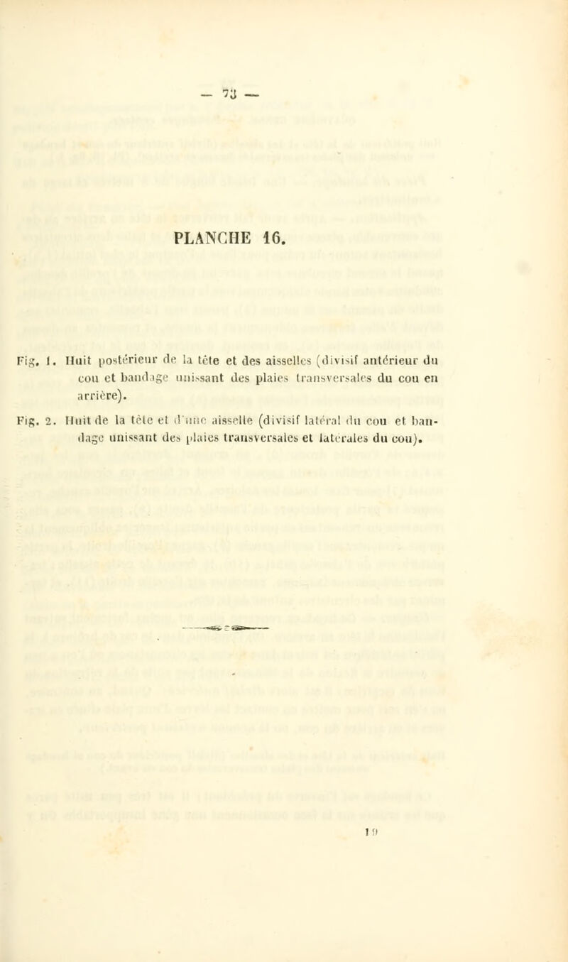 >a — PLANCHE 16. Fis, I. Huit postérieur de la tète et des aisselles (divisif antérieur du cou et bandage unissant des plaies transversales du cou en arrière). Fir. 2. Huit de la tcle et d*nfte aisselle (divisif latéral du cou et ban- dage unissant des plaies transversales et latérales du cou).