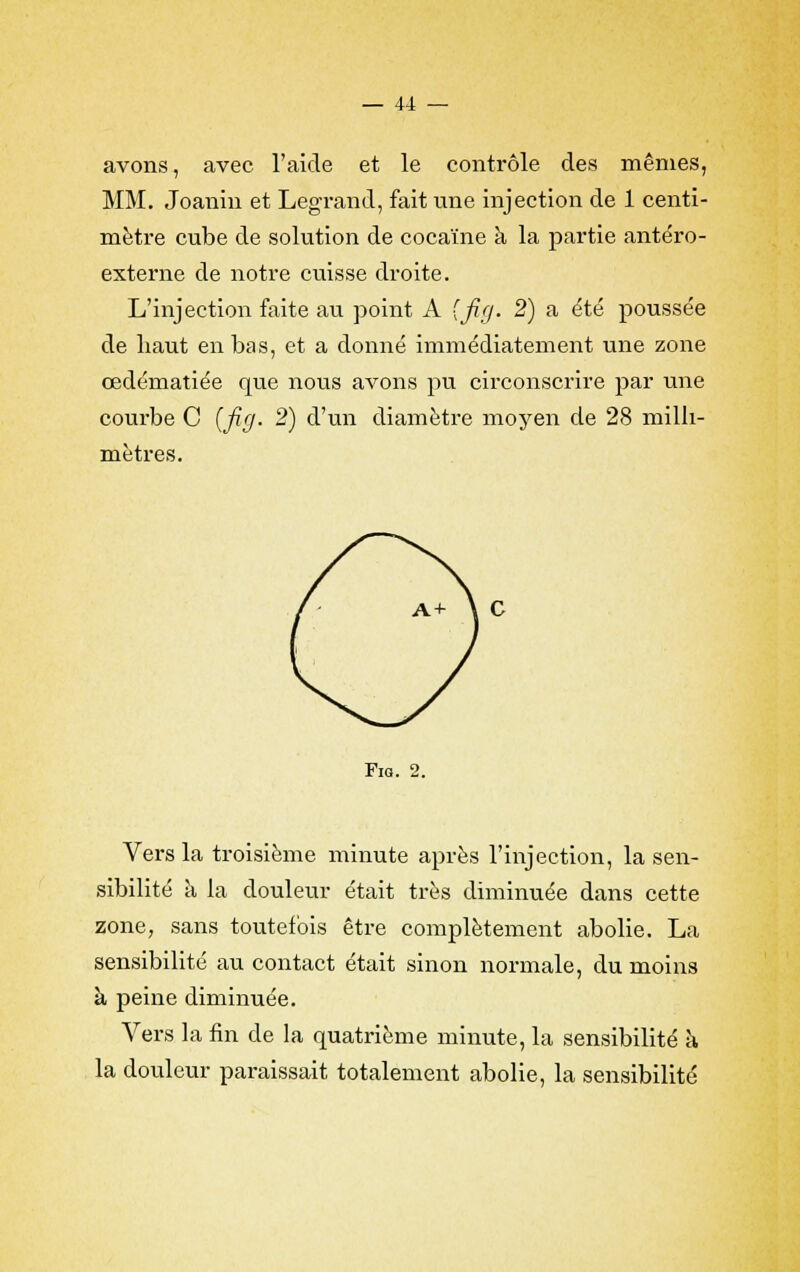 avons, avec l'aide et le contrôle des mêmes, MM. Joanin et Legrand, fait une injection de 1 centi- mètre cube de solution de cocaïne à la partie antéro- externe de notre cuisse droite. L'injection faite au point A {fig. 2) a été poussée de haut en bas, et a donné immédiatement une zone œdématiée que nous avons pu circonscrire par une courbe C (fig. 2) d'un diamètre moyen de 28 milli- mètres. Fig. 2. Vers la troisième minute après l'injection, la sen- sibilité à la douleur était très diminuée dans cette zone, sans toutefois être complètement abolie. La sensibilité au contact était sinon normale, du moins à peine diminuée. Vers la fin de la quatrième minute, la sensibilité à la douleur paraissait totalement abolie, la sensibilité