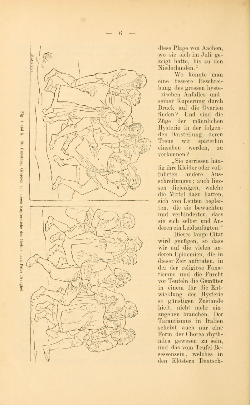 diese Plage von Aachen, wo sie sich im Juli ge- zeigt hatte, bis zu den Niederlanden. Wo könnte man eine bessere Beschrei- bung des grossen hyste- rischen Anfalles und seiner Kupierung durch Druck auf die Ovarien finden? Und sind die Züge der männlichen Hysterie in der folgen- den Darstellung, deren Treue wir späterhin einsehen werden, zu verkennen ? „Sie zerrissen häu- fig ihre Kleider oder voll- führten andere Aus- schreitungen ; auch Hes- sen diejenigen, welche die Mittel dazu hatten, sich von Leuten beglei- ten, die sie bewachten und verhinderten, dass sie sich selbst und An- deren ein Leid zufügten. Dieses lange Citat wird genügen, so dass wir auf die vielen an- deren Epidemien, die in dieser Zeit auftraten, in der der religiöse Fana- tismus und die Furcht vor Teufeln die Gemüter in einem für die Ent- wicklung der Hysterie so günstigen Zustande hielt, nicht mehr ein- zugehen brauchen. Der Tarantismus in Italien scheint auch nur eine Form der Chorea rhyth- mica gewesen zu sein, und das vom Teufel Be- sessensein , welches in den Klöstern Deutsch-