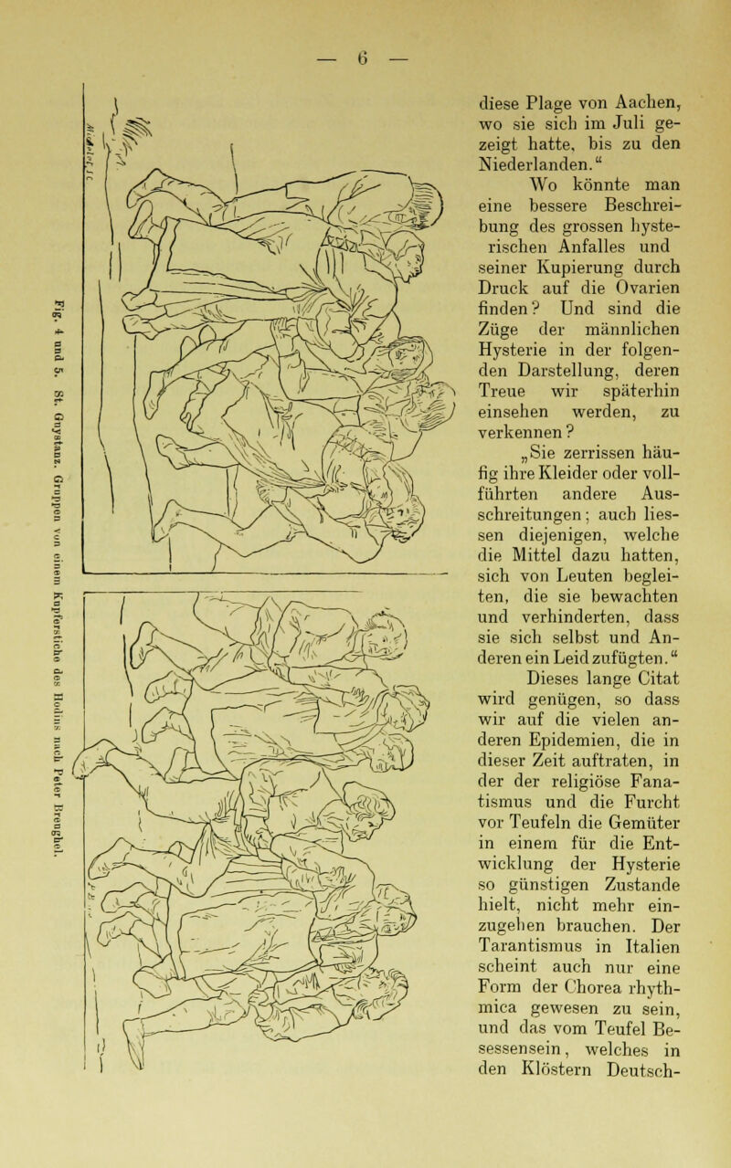 diese Plage von Aachen, wo sie sich im Juli ge- zeigt hatte, bis zu den Niederlanden. Wo könnte man eine bessere Beschrei- bung des grossen hyste- rischen Anfalles und seiner Kupierung durch Druck auf die Ovarien finden? Und sind die Züge der männlichen Hysterie in der folgen- den Darstellung, deren Treue wir späterhin einsehen werden, zu verkennen ? „Sie zerrissen häu- fig ihre Kleider oder voll- führten andere Aus- schreitungen ; auch Hes- sen diejenigen, welche die Mittel dazu hatten, sich von Leuten beglei- ten, die sie bewachten und verhinderten, dass sie sich selbst und An- deren ein Leid zufügten. Dieses lange Citat wird genügen, so dass wir auf die vielen an- deren Epidemien, die in dieser Zeit auftraten, in der der religiöse Fana- tismus und die Furcht vor Teufeln die Gemüter in einem für die Ent- wicklung der Hysterie so günstigen Zustande hielt, nicht mehr ein- zugehen brauchen. Der Tarantismus in Italien scheint auch nur eine Form der Chorea rhyth- mica gewesen zu sein, und das vom Teufel Be- sessensein , welches in den Klöstern Deutsch-