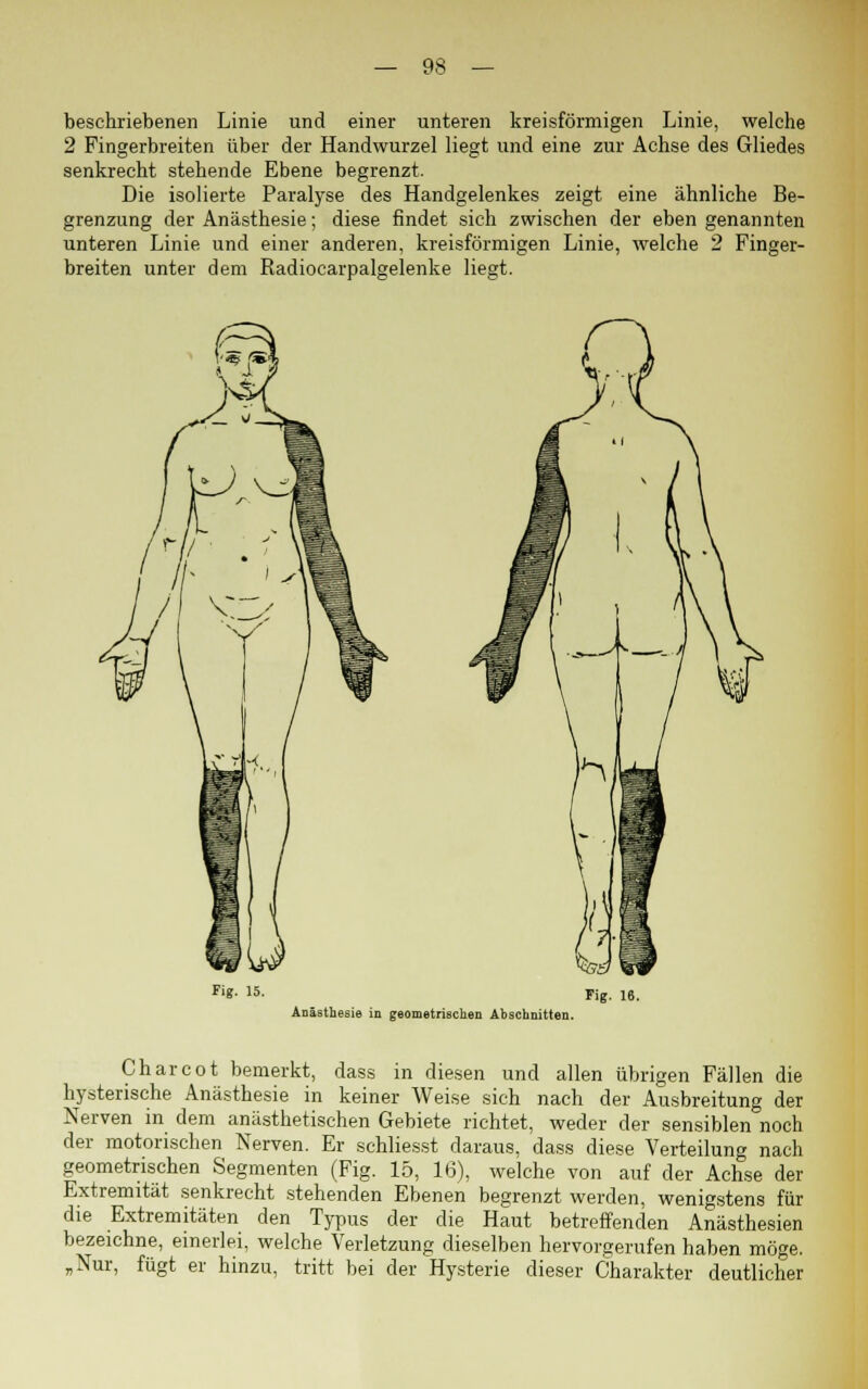 beschriebenen Linie und einer unteren kreisförmigen Linie, welche 2 Fingerbreiten über der Handwurzel liegt und eine zur Achse des Gliedes senkrecht stehende Ebene begrenzt. Die isolierte Paralyse des Handgelenkes zeigt eine ähnliche Be- grenzung der Anästhesie; diese findet sich zwischen der eben genannten unteren Linie und einer anderen, kreisförmigen Linie, welche 2 Finger- breiten unter dem Radiocarpalgelenke liegt. Fig. 15. Anästhesie in geometrischen Abschnitten. Fig. 16. Charcot bemerkt, dass in diesen und allen übrigen Fällen die hysterische Anästhesie in keiner Weise sich nach der Ausbreitung der Nerven in dem anästhetischen Gebiete richtet, weder der sensiblen noch der motorischen Nerven. Er schliesst daraus, dass diese Verteilung nach geometrischen Segmenten (Fig. 15, 16), welche von auf der Achse der Extremität senkrecht stehenden Ebenen begrenzt werden, wenigstens für die Extremitäten den Typus der die Haut betreffenden Anästhesien bezeichne, einerlei, welche Verletzung dieselben hervorgerufen haben möge. „Nur, fügt er hinzu, tritt bei der Hysterie dieser Charakter deutlicher