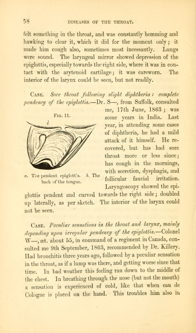 felt something in the throat, and was constantly hemming and hawking to clear it, which it did for the moment only; it made him cough also, sometimes most incessantly. Lungs were sound. The laryngeal mirror showed depression of the epiglottis, especially towards the right side, where it was in con- tact with the arytenoid cartilage; it was careworn. The interior of the larynx could be seen, but not readily. Case. Sore throat following slight diphtheria : complete pendency of the epiglottis.—Dr. S—, from Suffolk, consulted me, 17th June, 1863 ; was some years in India. Last year, in attending some cases of diphtheria, he had a mild attack of it himself. He re- covered, but has had sore throat more or less since; has cough in the mornings, with secretion, dysphagia, and follicular faucial irritation. Laryngoscopy showed the epi- glottis pendent and curved towards the right side; doubled up laterally, as per sketch. The interior of the larynx could not be seen. a. The pendent epiglottis, back of the tongue b. The Case. Peculiar sensations in the throat and larynx, mainly depending upon irregular pendency of the epiglottis.—Colonel \y—; get. about 55, in command of a regiment in Canada, con- sulted me 9th September, 1863, recommended by Dr. Killery. Had bronchitis three years ago, followed by a peculiar sensation in the throat, as if a lump was there, and getting worse since that time. In bad weather this feeling ran down to the middle of the chest. In breathing through the nose (but not the mouth) a sensation is experienced of cold, like that when eau de Cologne is placed on the hand. This troubles him also in