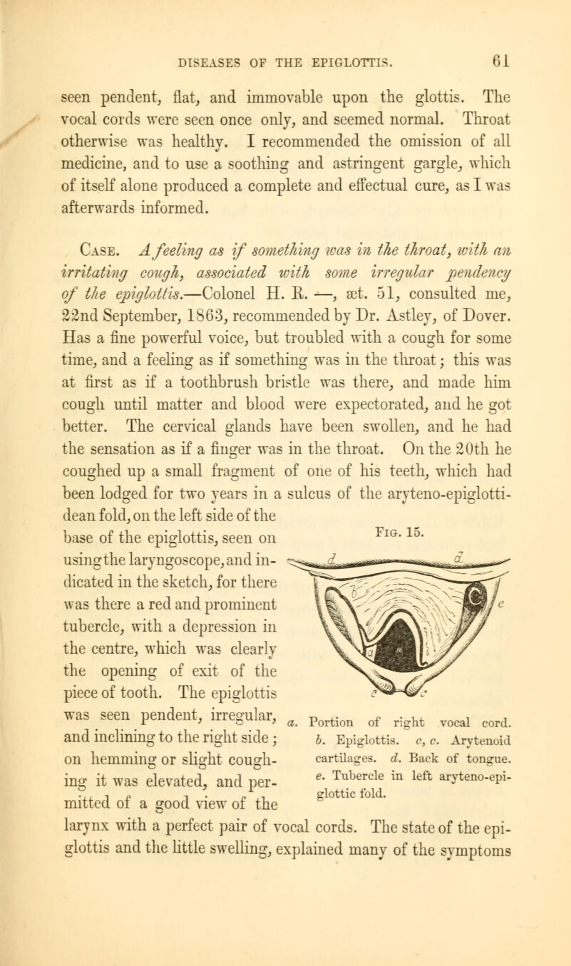 seen pendent, flat, and immovable upon the glottis. The vocal cords were seen once only, and seemed normal. Throat otherwise was healthy. I recommended the omission of all medicine, and to use a soothing and astringent gargle, which of itself alone produced a complete and effectual cure, as I was afterwards informed. Case. A feeling as if something icas in the throat, icith an irritating cough, associated with some irregular pendency of the epiglottis.—Colonel H. R. —, set. 51, consulted me, 22nd September, 1863, recommended by Dr. Astley, of Dover. Has a fine powerful voice, but troubled with a cough for some time, and a feeling as if something was in the throat; this was at first as if a toothbrush bristle was there, and made him cough until matter and blood were expectorated, and he got better. The cervical glands have been swollen, and he had the sensation as if a finger was in the throat. On the 20th he coughed up a small fragment of one of his teeth, which had been lodged for two years in a sulcus of the aryteno-epiglotti- dean fold, on the left side of the base of the epiglottis, seen on FlG*lo- usingthe laryngoscope, and in- dicated in the sketch, for there was there a red and prominent tubercle, with a depression in the centre, which was clearly the opening of exit of the piece of tooth. The epiglottis was seen pendent, irregular, and inclining; to the right side ; on hemming or slight cough- ing it was elevated, and per- mitted of a good view of the larynx with a perfect pair of vocal cords. The state of the epi- glottis and the little swelling, explained many of the symptoms Portion of right vocal cord. b. Epiglottis, c, c. Arytenoid cartilages, d. Back of tongue. e. Tubercle in left aryteno-epi- glottic fold.