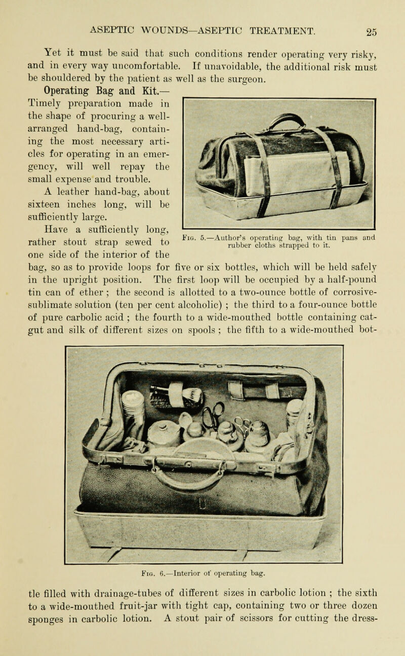 Yet it must be said that such conditions render operating very risky, and in every way uncomfortable. If unavoidable, the additional risk must be shouldered by the patient as well as the surgeon. Operating Bag and Kit.— Timely preparation made in the shape of procuring a well- arranged hand-bag, contain- ing the most necessary arti- cles for operating in an emer- gency, will well repay the small expense and trouble. A leather hand-bag, about sixteen inches long, will be sufficiently large. Have a sufficiently long, rather stout strap sewed to one side of the interior of the bag, so as to provide loops for five or six bottles, which will be held safely in the upright position. The first loop will be occupied by a half-pound tin can of ether ; the second is allotted to a two-ounce bottle of corrosive- sublimate solution (ten per cent alcoholic) ; the third to a four-ounce bottle of pure carbolic acid ; the fourth to a wide-mouthed bottle containing cat- gut and silk of different sizes on spools ; the fifth to a wide-mouthed bot- Fig. 5.- -Author's operating bag, with tin pans and rubber cloths strapped to it. Fig. 6.—Interior of operating bag. tie filled with drainage-tubes of different sizes in carbolic lotion ; the sixth to a wide-mouthed fruit-jar with tight cap, containing two or three dozen sponges in carbolic lotion. A stout pair of scissors for cutting the dress-