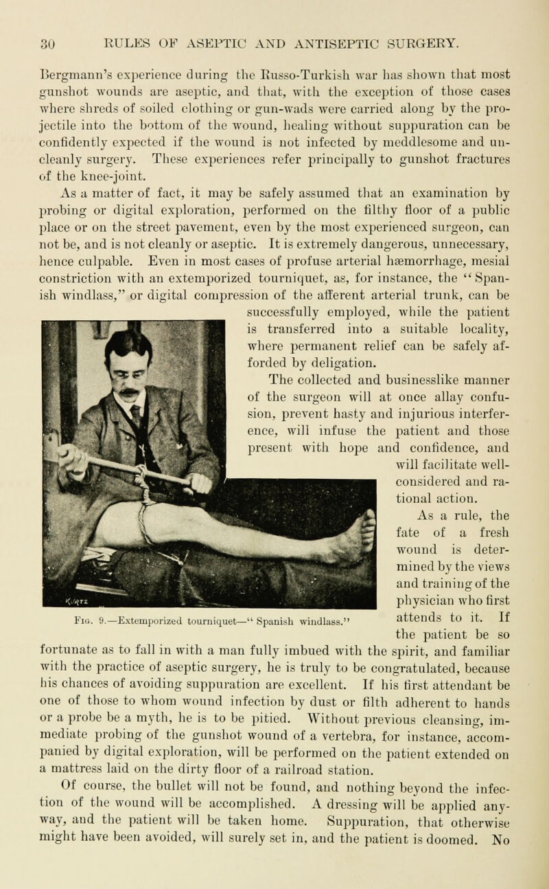 Bergmann's experience during the Kusso-Turkish war has shown that most gunshot wounds are aseptic, and that, with the exception of those cases where shreds of soiled clothing or gun-wads were carried along by the pro- jectile into the bottom of the wound, healing without suppuration can be confidently expected if the wound is not infected by meddlesome and un- cleanly surgery. These experiences refer principally to gunshot fractures of the knee-joint. As a matter of fact, it may be safely assumed that an examination by probing or digital exploration, performed on the filthy floor of a public place or on the street pavement, even by the most experienced surgeon, can not be, and is not cleanly or aseptic. It is extremely dangerous, unnecessary, hence culpable. Even in most cases of profuse arterial haemorrhage, mesial constriction with an extemporized tourniquet, as, for instance, the Span- ish windlass, or digital compression of the afferent arterial trunk, can be successfully employed, while the patient is transferred into a suitable locality, where permanent relief can be safely af- forded by deligation. The collected and businesslike manner of the surgeon will at once allay confu- sion, prevent hasty and injurious interfer- ence, will infuse the patient and those present with hope and confidence, and will facilitate well- considered and ra- tional action. As a rule, the fate of a fresh wound is deter- mined by the views and training of the physician who first attends to it. If the patient be so fortunate as to fall in with a man fully imbued with the spirit, and familiar with the practice of aseptic surgery, he is truly to be congratulated, because his chances of avoiding suppuration are excellent. If his first attendant be one of those to whom wound infection by dust or filth adherent to hands or a probe be a myth, he is to be pitied. Without previous cleansing, im- mediate probing of the gunshot wound of a vertebra, for instance, accom- panied by digital exploration, will be performed on the patient extended on a mattress laid on the dirty floor of a railroad station. Of course, the bullet will not be found, and nothing beyond the infec- tion of the wound will be accomplished. A dressing will be applied any- way, and the patient will be taken home. Suppuration, that otherwise might have been avoided, will surely set in, and the patient is doomed. No Fig. 9.—Extemporized tourniquet— Spanish windlass.