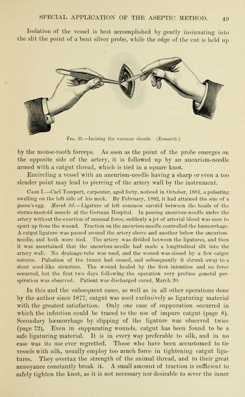 Isolation of the vessel is best accomplished by gently insinuating' into the slit the point of a bent silver probe, while the edge of the cut is held up Fig. 33.—Incising the vascular sheath. (Esmarch.) by the mouse-tooth forceps. As soon as the point of the probe emerges on the opposite side of the artery, it is followed up by an aneurism-needle armed with a catgut thread, which is tied in a square knot. Encircling a vessel with an aneurism-needle having a sharp or even a too slender point may lead to piercing of the artery wall by the instrument. Case I.—Carl Tompert, carpenter, aged forty, noticed in October, 1881, a pulsating swelling on the left side of his neck. By February, 1882, it had attained the size of a goose's egg. March. 2d.—Ligature of left common carotid between the heads of the sterno-mastoid muscle at the German Hospital. In passing aneurism-needle under the artery without the exertion of unusual force, suddenly a jet of arterial blood was seen to spurt up from the wound. Traction on the aneurism-needle controlled the haemorrhage. A catgut ligature was passed around the artery above and another below the aneurism- needle, and both were tied. The artery was divided between the ligatures, and then it was ascertained that the aneurism-needle had made a longitudinal slit into the artery wall. No drainage-tube was used, and the wound was closed by a few catgut sutures. Pulsation of the tumor had ceased, and subsequent^ it shrunk away to a stout cord-like structure. The wound healed by the first intention and no fever occurred, but the first two days following the operation very profuse general per- spiration was observed. Patient was discharged cured, March 20. In this and the subsecpient cases, as well as in all other operations done by the author since 1877, catgut was used exclusively as ligaturing material with the greatest satisfaction. Only oue case of suppuration occurred in which the infection could be traced to the use of impure catgut (page 8). Secondary haemorrhage by slipping of the ligature was observed twice (page 72). Even in suppurating wounds, catgut has been found to be a safe ligaturing material. It is in every way preferable to silk, and in no case was its use ever regretted. Those who have been accustomed to tie vessels with silk, usually employ too much force in tightening catgut liga- tures. They overtax the strength of the animal thread, and to their great annoyance constantly break it. A small amount of traction is sufficient to safely tighten the knot, as it is not necessary nor desirable to sever the inner