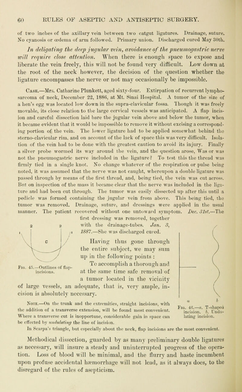 of two inches of the axillary vein between two catgut ligatures. Drainage, suture. No cyanosis or oedema of arm followed. Primary union. Discharged cured May 30th. In deligating the deep jugular vein, avoidance of the pneumogastric nerve will require close attention. When there is enough space to expose and liberate the vein freely, this will not be found very difficult. Low down at the root of the neck however, the decision of the question whether the ligature encompasses the nerve or not may occasionally be impossible. Case.—Mrs. Catharine Plunkett, aged sixty-four. Extirpation of recurrent lympho- sarcoma of neck, December 22, 1886, at Mt. Sinai Hospital. A tumor of the size of a hen's egg was located low down in the supra-clavicular fossa. Though it was freely movable, its close relation to the large cervical vessels was anticipated. A flap incis- ion and careful dissection laid bare the jugular vein above and below the tumor, when it became evident that it would be impossible to remove it without excising a correspond- ing portion of the vein. The lower ligature had to be applied somewhat behind the sterno-clavicular rim, and on account of the lack of space this was very difficult. Isola- tion of the vein had to be done with the greatest caution to avoid its injury. Finally a silver probe wormed its way around the vein, and the question arose, Was or was not the pneumogastric nerve included in the ligature? To test this the thread was firmly tied in a single knot. No change whatever of the respiration or pulse being noted, it was assumed that the nerve was not caught, whereupon a double ligature was passed through by means of the first thread, and, being tied, the vein was cut across. But on inspection of the mass it became clear that the nerve was included in the liga- ture and had been cut through. The tumor was easily dissected up after this until a pedicle was formed containing the jugular vein from above. This being tied, the tumor was removed. Drainage, suture, and dressings were applied in the usual recovered without one untoward symptom. Bee. 31st.—The first dressing was removed, together with the drainage-tubes. Jan. 3, 1SS7.—She was discharged cuied. Having thus gone through the entire subject, we may sum up in the following points : To accomplish a thorough and at the same time safe removal of a tumor located in the vicinity of large vessels, an adequate, that is, very ample, in- cision is absolutely necessary. Note.—On the trunk and the extremities, straight incisions, with the addition of a transverse extension, will be found most convenient. Where a transverse cut is inopportune, considerable gain in space can be effected by undulating the line of incisiun. In Scarpa's triangle, but especially about the neck, flap incisions are the most convenient. Methodical dissection, guarded by as many preliminary double ligatures as necessary, will insure a steady and uninterrupted progress of the opera- tion. Loss of blood will be minimal, and the flurry and haste incumbent upon profuse accidental haemorrhage will not lead, as it always does, to the disregard of the rules of asepticism. manner. The patient Fio. 45.—Outlines of flap incisions. Fig. 46.—a. T-shaped incision. 5. Undu- lating incision.