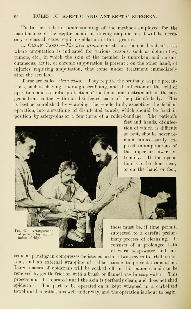 To further a better understanding of the methods employed for the maintenance of the aseptic condition during amputation, it will be neces- sary to class all cases requiring ablation in three groups. a. Clean Cases. — The first group consists, on the one hand, of cases where amputation is indicated for various reasons, sucli as deformities, tumors, etc., in which the skin of the member is unbroken, and no sub- cutaneous, acute, or chronic suppuration is present; on the other hand, of injuries requiring amputation, that come under treatment immediately after the accident. These are called clean cases. They require the ordinary aseptic precau- tions, such as shaving, thorough scrubbing, and disinfection of the field of operation, and a careful protection of the hands and instruments of the sur- geons from contact with non-disinfected parts of the patient's body. This is best accomplished by wrapping the whole limb, excepting the field of operation, into a swathing of disinfected towels, which should be fixed in position by safety-pins or a few turns of a roller-bandage. The patient's feet and hands, disinfec- tion of which is difficult at best, should never re- main unnecessarily ex- posed in amputations of the upper or lower ex- tremity. If the opera- tion is to be done near, or on the hand or foot, these must be, if time permit, Fig. 47.—Arrangement iST'^'Sl M'*'- '''J i • l t i. £ 1 v of patient for :impu- J[ \^*B - I subjected to a careful prelim- inary process of cleansing. It consists of a prolonged bath of warm soap-water, and sub- sequent packing in compresses moistened with a two-per-cent carbolic solu- tion, and an external wrapping of rubber tissue to prevent evaporation. Large masses of epidermis will be soaked off in this manner, and can be removed by gentle friction with a brush or flannel rag in soap-water. This process must be repeated until the skin is perfectly clean, and does not shed epidermis. The part to be operated on is kept wrapped in a carbolized towel until anaesthesia is well under way, and the operation is about to begin.