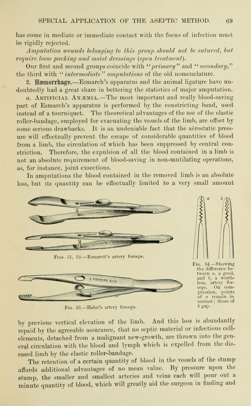 has come in mediate or immediate contact with the focus of infection must be rigidly rejected. Amputation wounds belonging to this group should not be sutured, but require loose packing and moist dressings {open treatment). Our first and second groups coincide with primary and secondary, the third with  intermediate  amputations of the old nomenclature, 2. Haemorrhage.—Esmarch's apparatus and the animal ligature have un- doubtedly had a great share in bettering the statistics of major amputation. a. Artificial Anemia.—The most important and really blood-saving part of Esmarch's apparatus is performed by the constricting band, used instead of a tourniquet. The theoretical advantages of the use of the elastic roller-bandage, employed for evacuating the vessels of the limb, are offset by some serious drawbacks. It is an undeniable fact that the aerostatic press- ure will effectually prevent the escape of considerable quantities of blood from a limb, the circulation of which has been suppressed by central con- striction. Therefore, the expulsion of all the blood contained in a limb is not an absolute requirement of blood-saving in non-mutilating operations, as, for instance, joint exsections. In amputations the blood contained in the removed limb is an absolute loss, but its quantity can be effectually limited to a very small amount Figs. 61, 52.—Esmarch's artery forceps. Fig. 53.—Hahn's artery forceps. Fig. 54.—Showing the difference be- tween «, a good, and b, a worth- less, artery for- ceps. On com- pression, points of a remain in contact; those of b gap. by previous vertical elevation of the limb. And this loss is abundantly repaid by the agreeable assurance, that no septic material or infectious cell- elements, detached from a malignant new-growth, are thrown into the gen- eral circulation with the blood and lymph which is expelled from the dis- eased limb by the elastic roller-bandage. The retention of a certain quantity of blood in the vessels of the stump affords additional advantages of no mean value. By pressure upon the stump, the smaller and smallest arteries and veins each will pour out a minute quantity of blood, which will greatly aid the surgeon in finding and