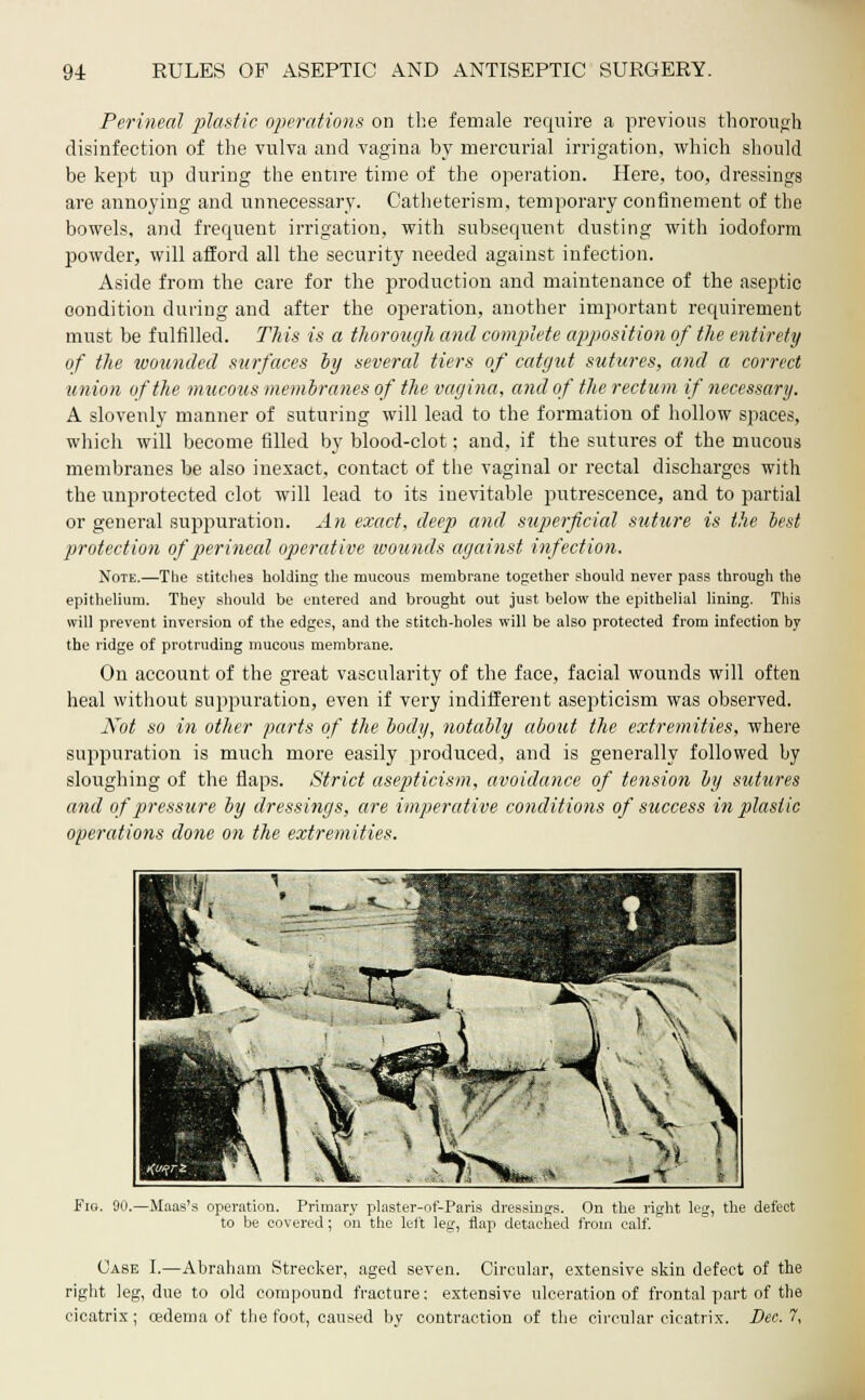 Perineal plastic operations on the female require a previous thorough disinfection of the vulva and vagina by mercurial irrigation, which should be kept up during the entire time of the operation. Here, too, dressings are annoying and unnecessary. Catheterism, temporary confinement of the bowels, and frequent irrigation, with subsequent dusting with iodoform powder, will afford all the security needed against infection. Aside from the care for the production and maintenance of the aseptic condition during and after the operation, another important requirement must be fulfilled. This is a thorough and complete apposition of the entirety of the wounded surfaces by several tiers of catgut sutures, and a correct union of the mucous membranes of the vagina, and of the rectum if necessary. A slovenly manner of suturing will lead to the formation of hollow spaces, which will become filled by blood-clot; and, if the sutures of the mucous membranes be also inexact, contact of the vaginal or rectal discharges with the unprotected clot will lead to its inevitable putrescence, and to partial or general suppuration. An exact, deep and superficial suture is the best protection of perineal operative wounds against infection. Note.—The stitches holding the mucous membrane together should never pass through the epithelium. They should be entered and brought out just below the epithelial lining. This will prevent inversion of the edges, and the stitch-holes will be also protected from infection by the ridge of protruding mucous membrane. On account of the great vascularity of the face, facial wounds will often heal without suppuration, even if very indifferent asepticism was observed. Not so in other parts of the body, notably about the extremities, where suppuration is much more easily produced, and is generally followed by sloughing of the flaps. Strict asepticism, avoidance of tension by sutures and of pressure by dressings, are imperative conditions of success in plastic operations done on the extremities. Fig. 90.—Maas's operation. Primary plaster-of-Paris dressings. On the right leg, the defect to be covered; on the left leg, flap detached from calf. Case I.—Abraham Strecker, aged seven. Circular, extensive skin defect of the right leg, due to old compound fracture; extensive ulceration of frontal part of the cicatrix; oedema of the foot, caused by contraction of the circular cicatrix. Dec. 7,