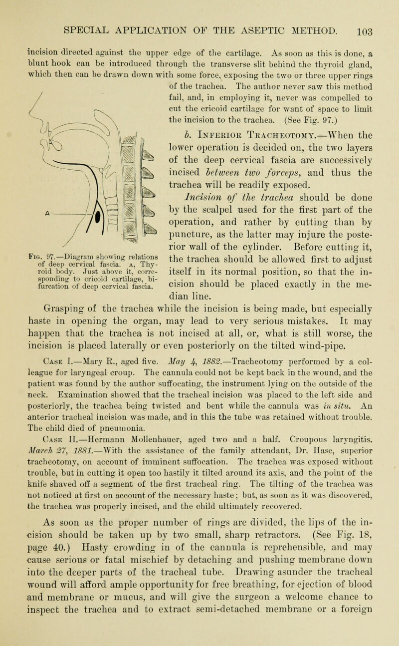 Fig. 97.—Diagram showing relations of deep cervical fascia, a, Thy- roid body. Just above it, corre- sponding to cricoid cartilage, bi- furcation of deep cervical fascia. incision directed against the upper edge of the cartilage. As soon as this is done, a blunt hook can he introduced through the transverse slit behind the thyroid gland, which then can be drawn down with some force, exposing the two or three upper rings of the trachea. The author never saw this method fail, and, in employing it, never was compelled to cut the cricoid cartilage for want of space to limit the incision to the trachea. (See Fig. 97.) b. Inferior Tracheotomy.—When the lower operation is decided on, the two layers of the deep cervical fascia are successively incised between two forceps, and thus the trachea will be readily exposed. Incision of the trachea should be done by the scalpel used for the first part of the operation, and rather by cutting than by puncture, as the latter may injure the poste- rior wall of the cylinder. Before cutting it, the trachea should be allowed first to adjust itself in its normal position, so that the in- cision should be placed exactly in the me- dian line. Grasping of the trachea while the incision is being made, but especially haste in opening the organ, may lead to very serious mistakes. It may happen that the trachea is not incised at all, or, what is still worse, the incision is placed laterally or even posteriorly on the tilted wind-pipe. Case I.—Mary E., aged five. May 4> 1882.—Tracheotomy performed by a col- league for laryngeal croup. The cannula could not be kept hack in the wound, and the patient was found by the author suffocating, the instrument lying on the outside of the neck. Examination showed that the tracheal incision was placed to the left side and posteriorly, the trachea being twisted and bent while the cannula was in situ. An anterior tracheal incision was made, and in this the tube was retained without trouble. The child died of pneumonia. Case II.—Hermann Mollenhauer, aged two and a half. Croupous laryngitis. March 27, 1881.—With the assistance of the family attendant, Dr. Hase, superior tracheotomy, on account of imminent suffocation. The trachea was exposed without trouble, but in cutting it open too hastily it tilted around its axis, and the point of tlie knife shaved off a segment of the first tracheal ring. The tilting of the trachea was not noticed at first on account of the necessary haste; but, as soon as it was discovered, the trachea was properly incised, and the child ultimately recovered. As soon as the proper number of rings are divided, the lips of the in- cision should be taken up by two small, sharp retractors. (See Fig. 18, page 40.) Hasty crowding in of the cannula is reprehensible, and may cause serious or fatal mischief by detaching and pushing membrane down into the deeper parts of the tracheal tube. Drawing asunder the tracheal wound will afford ample opportunity for free breathing, for ejection of blood and membrane or mucus, and will give the surgeon a welcome chance to inspect the trachea and to extract semi-detached membrane or a foreign